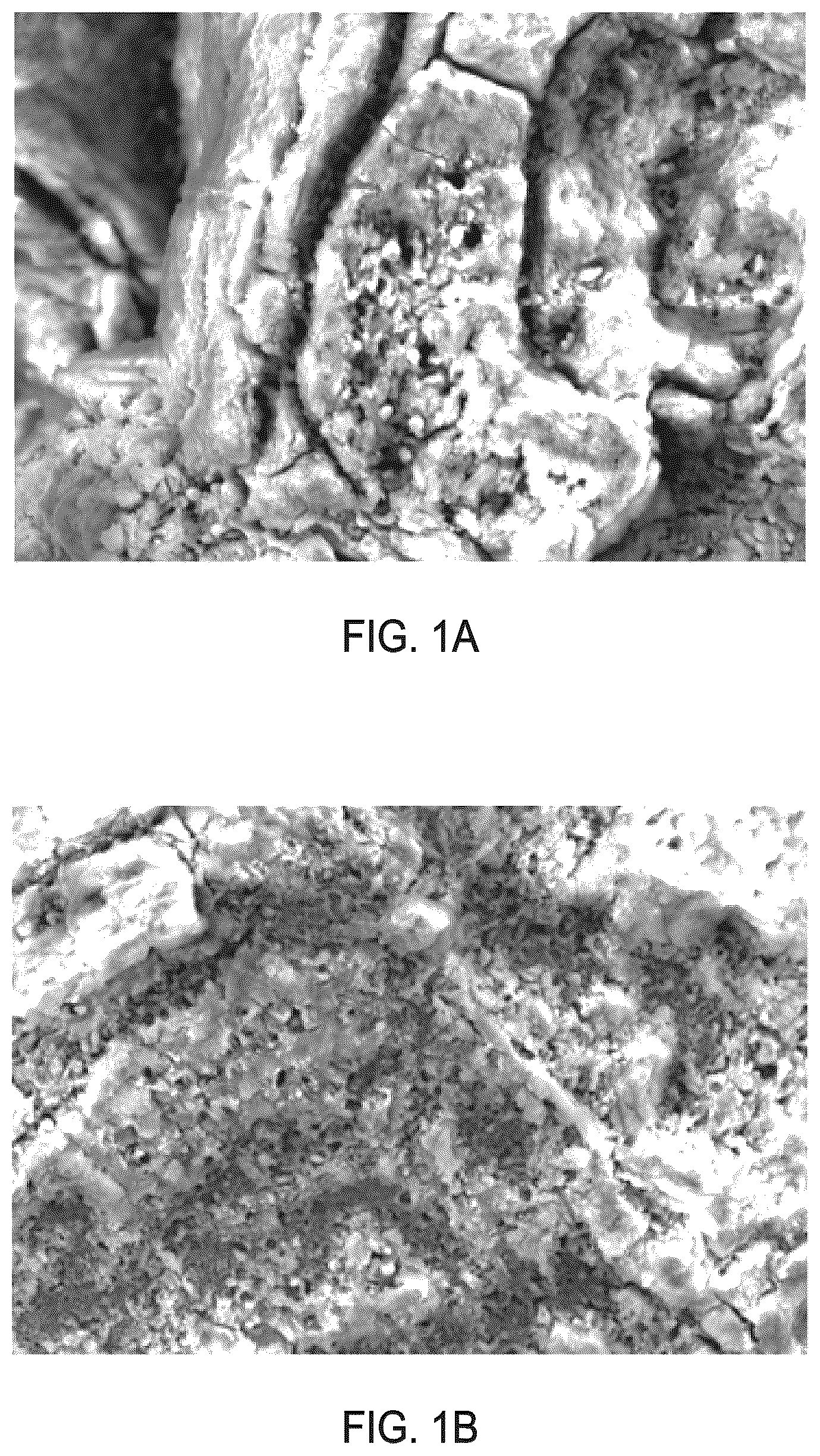 Patent US12616576 — Methods of modifying the porous surface of implants — Figure 1