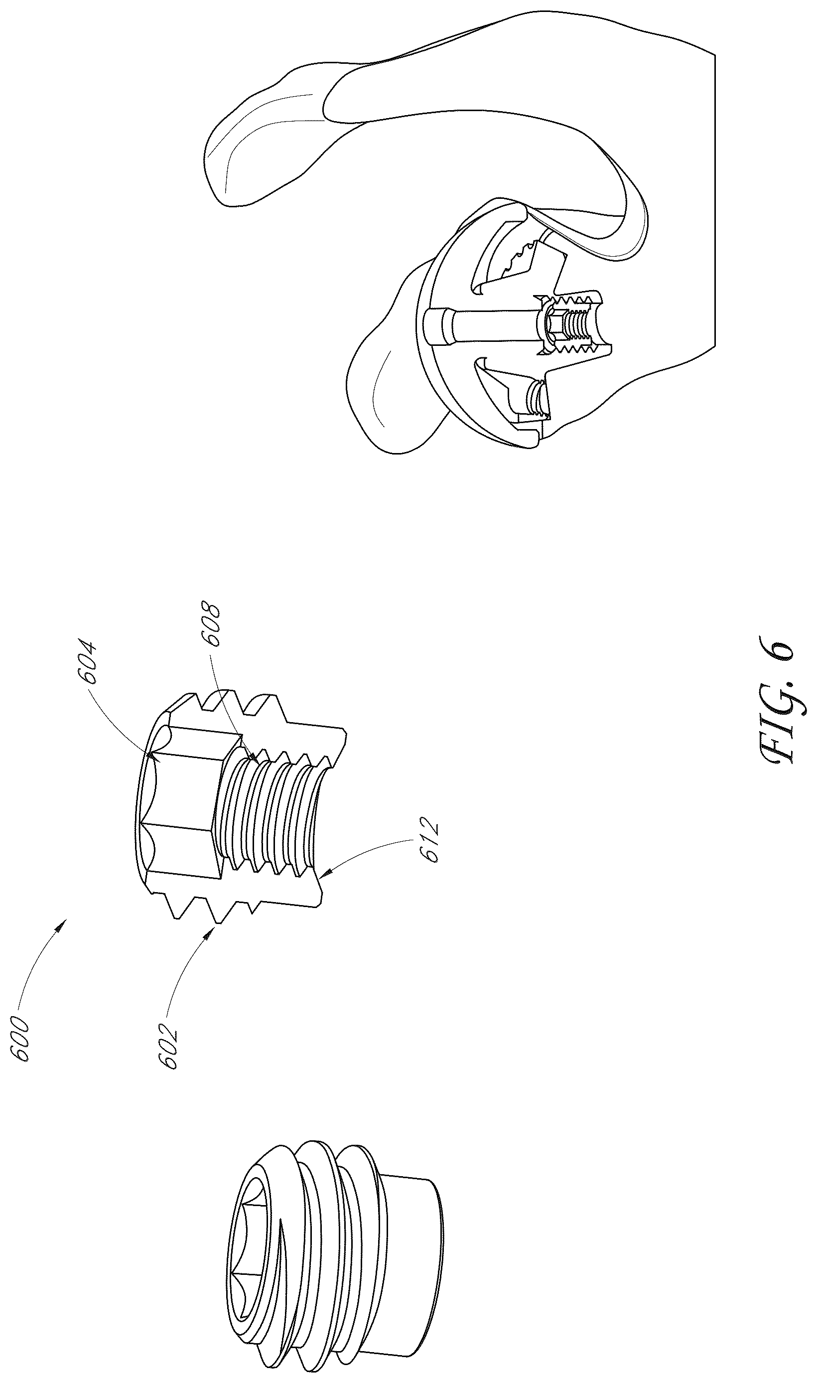 Patent US12616578 Figure 6 – Total reverse shoulder systems and methods