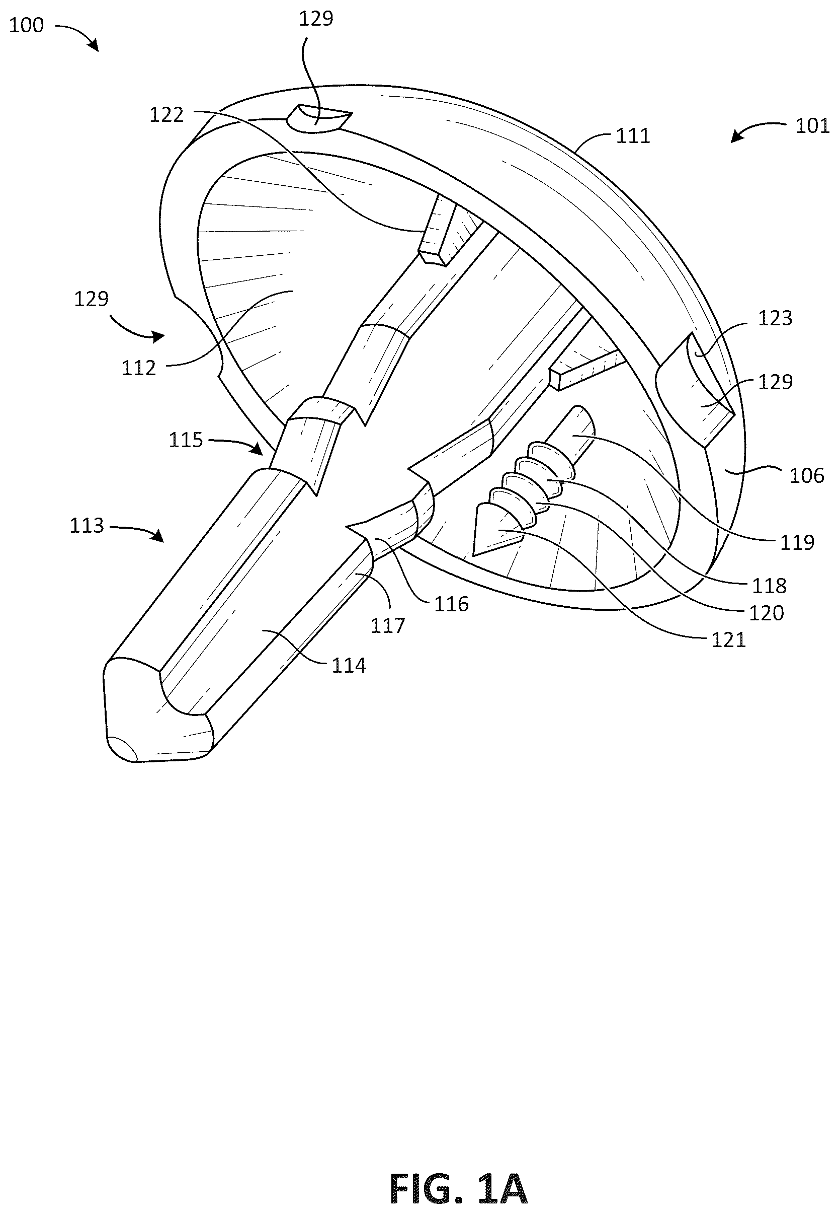 Patent US12616579 — Metatarsal arthroplasty devices, systems, and methods — Figure 1