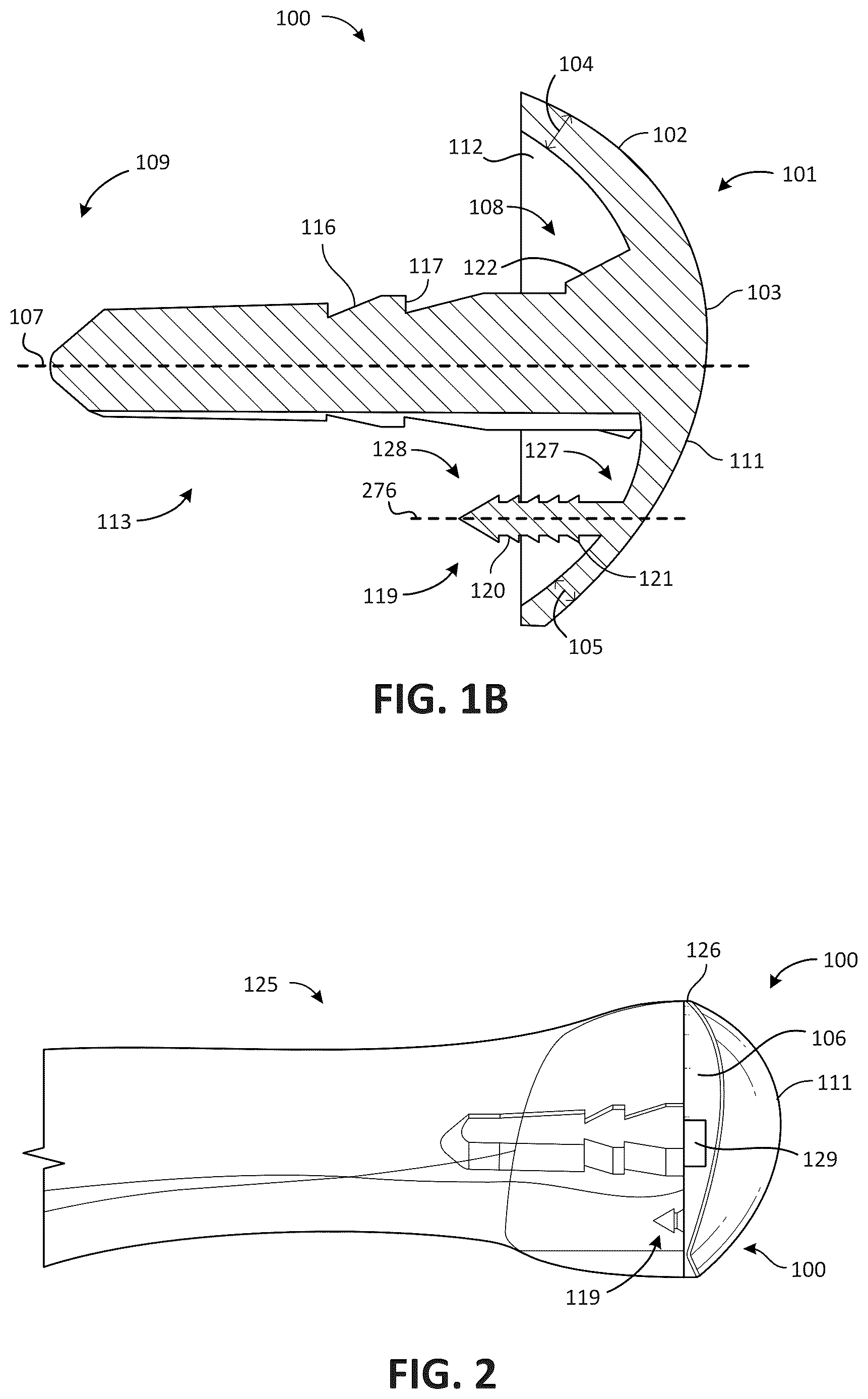 Patent US12616579 Figure 2 – Metatarsal arthroplasty devices, systems, and methods