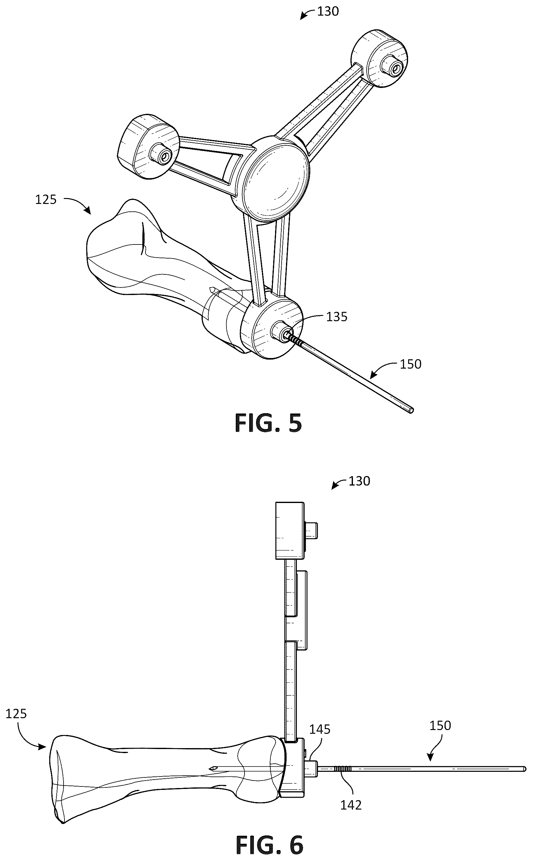 Patent US12616579 Figure 4 – Metatarsal arthroplasty devices, systems, and methods