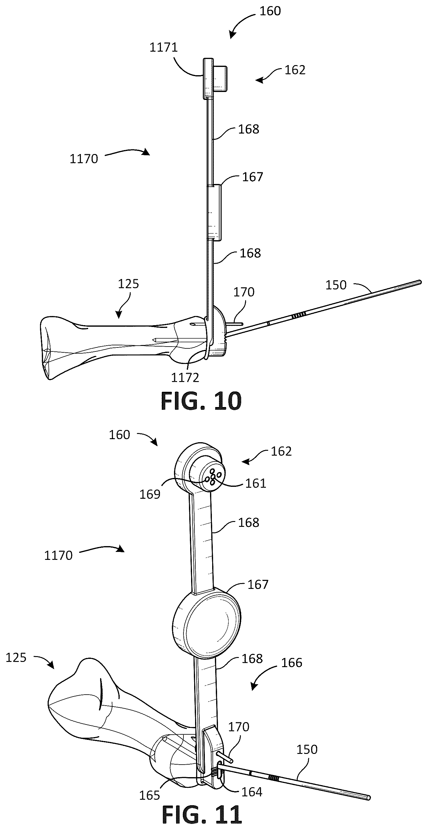 Patent US12616579 Figure 6 – Metatarsal arthroplasty devices, systems, and methods