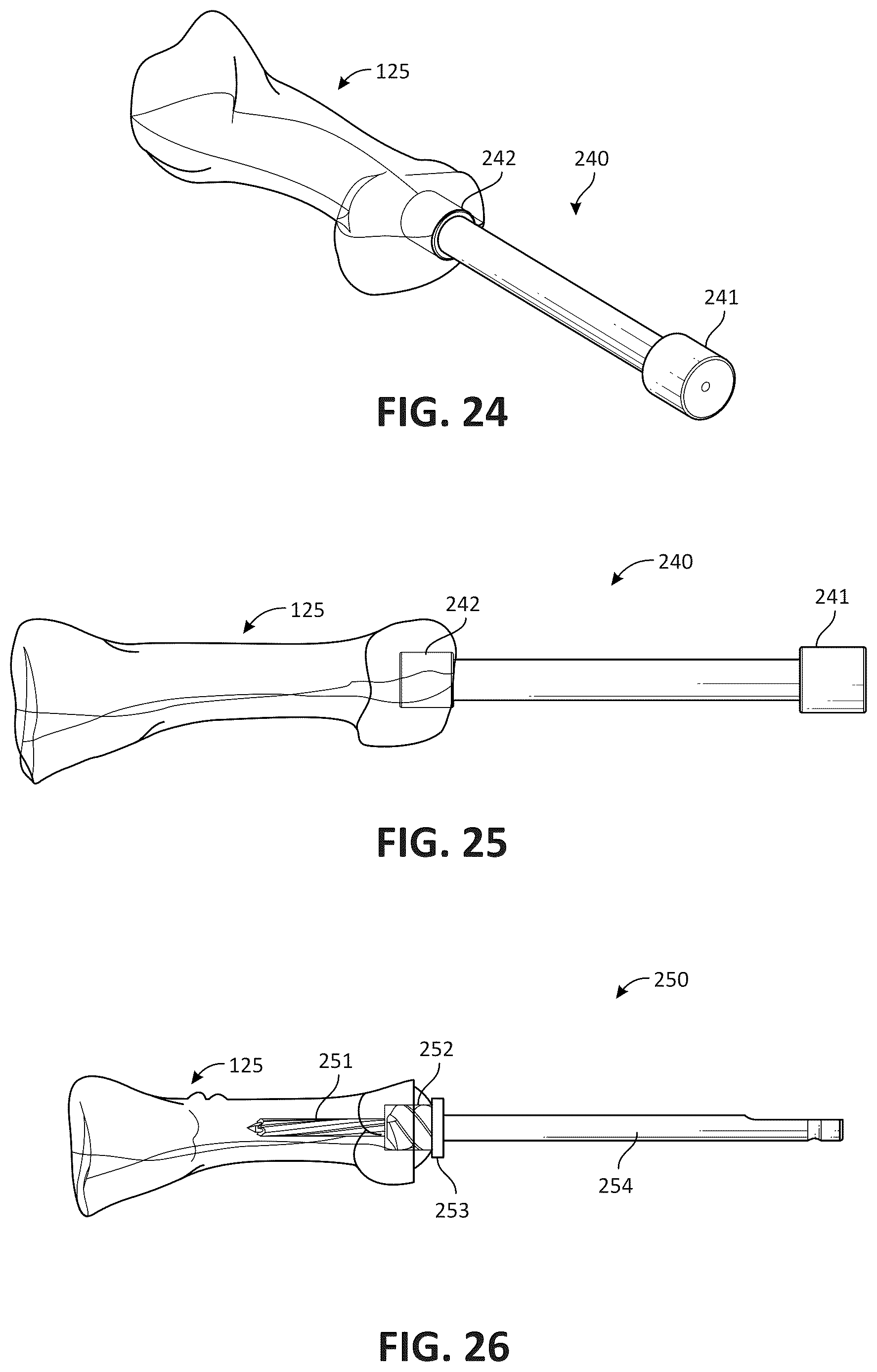 Patent US12616579 Figure 14 – Metatarsal arthroplasty devices, systems, and methods