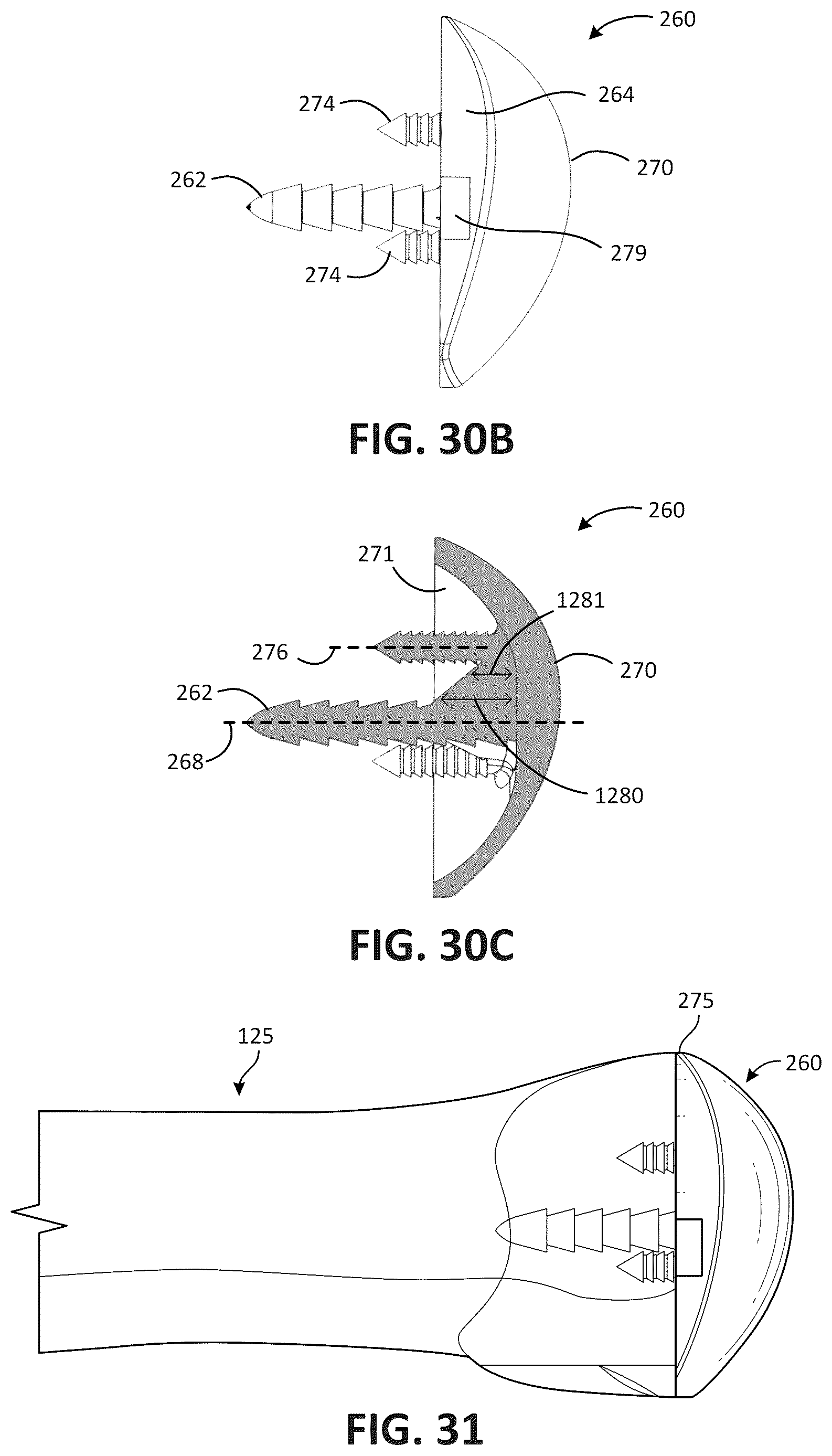 Patent US12616579 Figure 17 – Metatarsal arthroplasty devices, systems, and methods