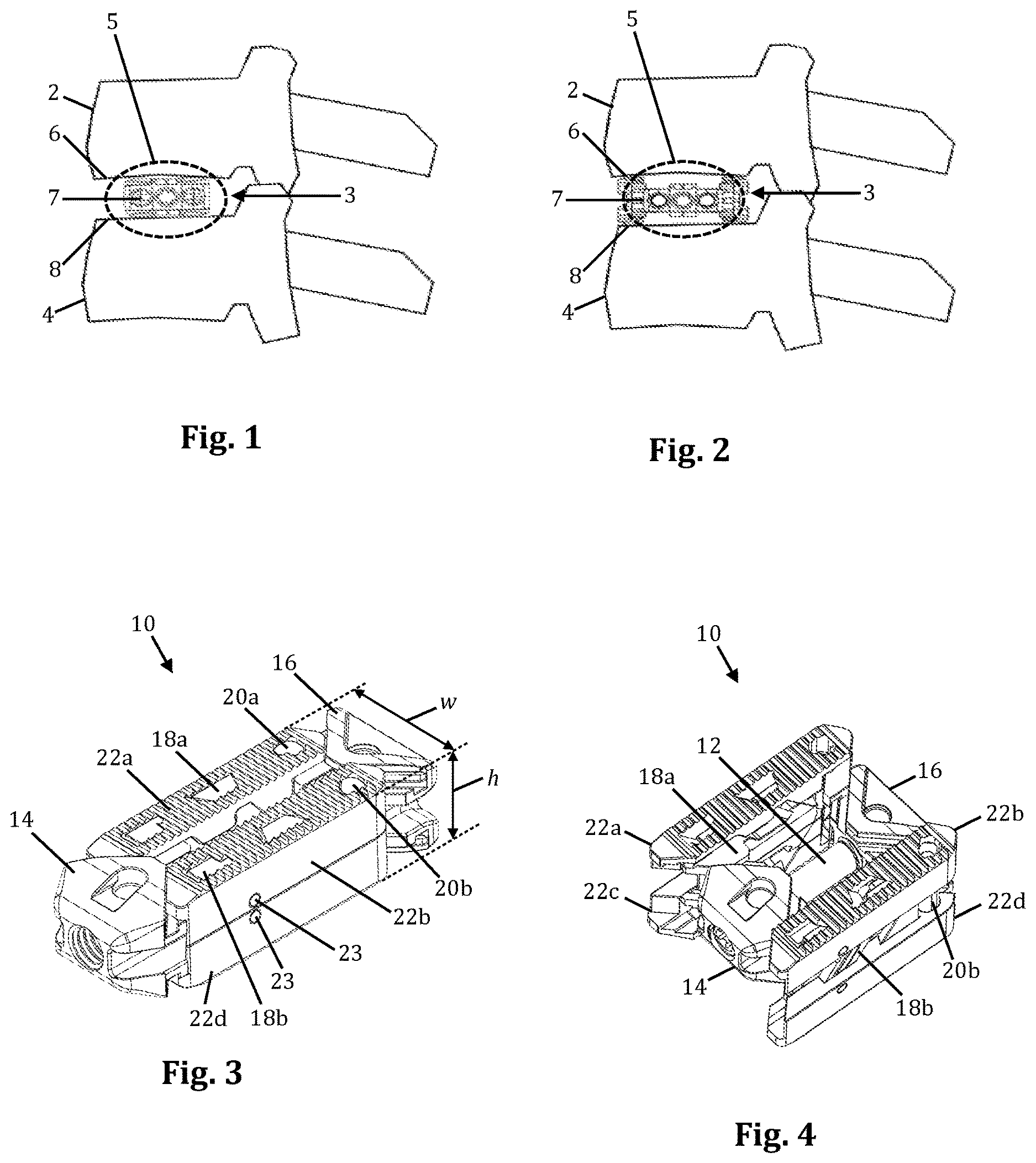 Patent US12616583 — Expandable fusion device with independent expansion systems — Figure 1