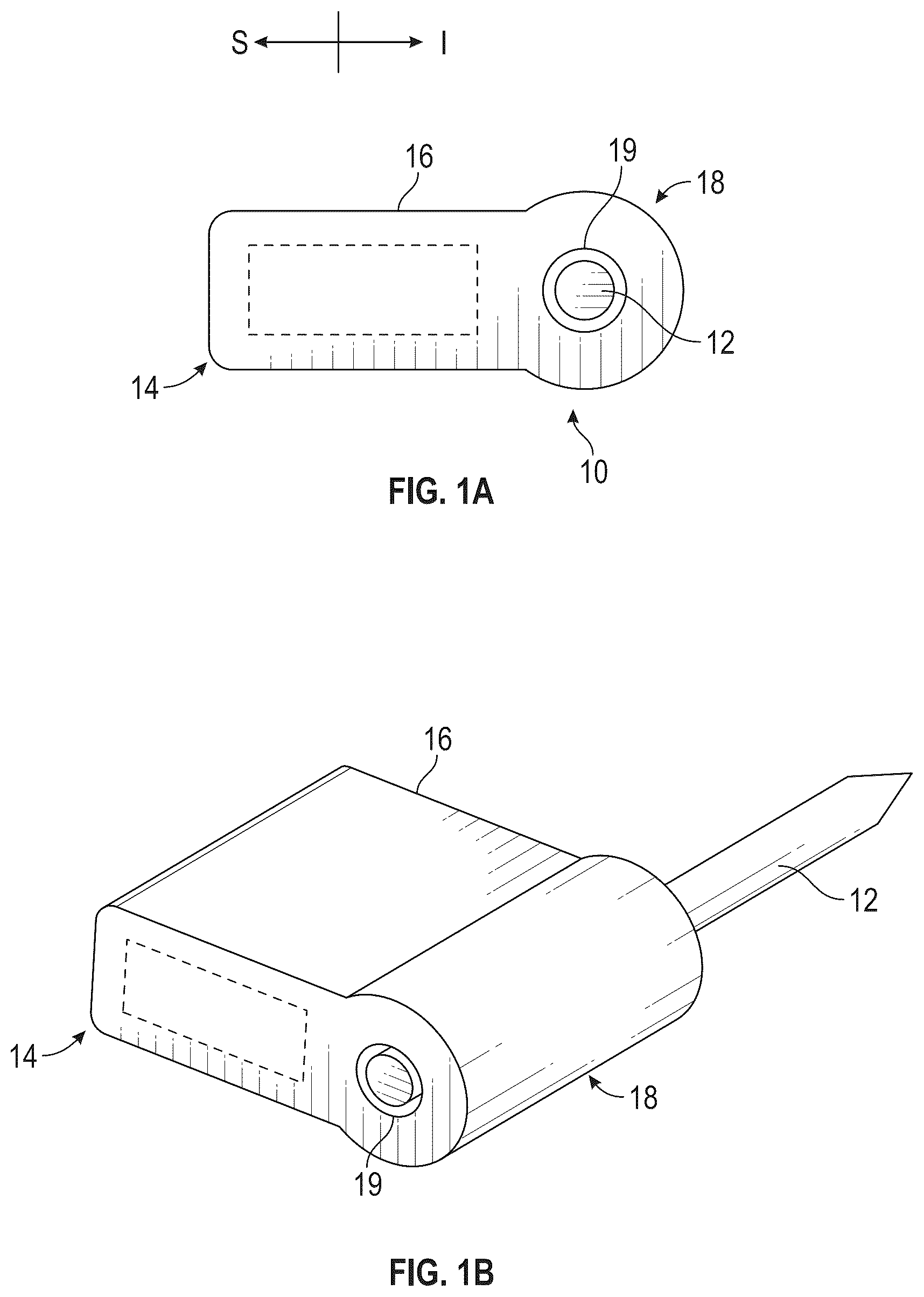 Patent US12616587 Figure 1 – Sacro-iliac joint stabilizing implants and methods of implantation