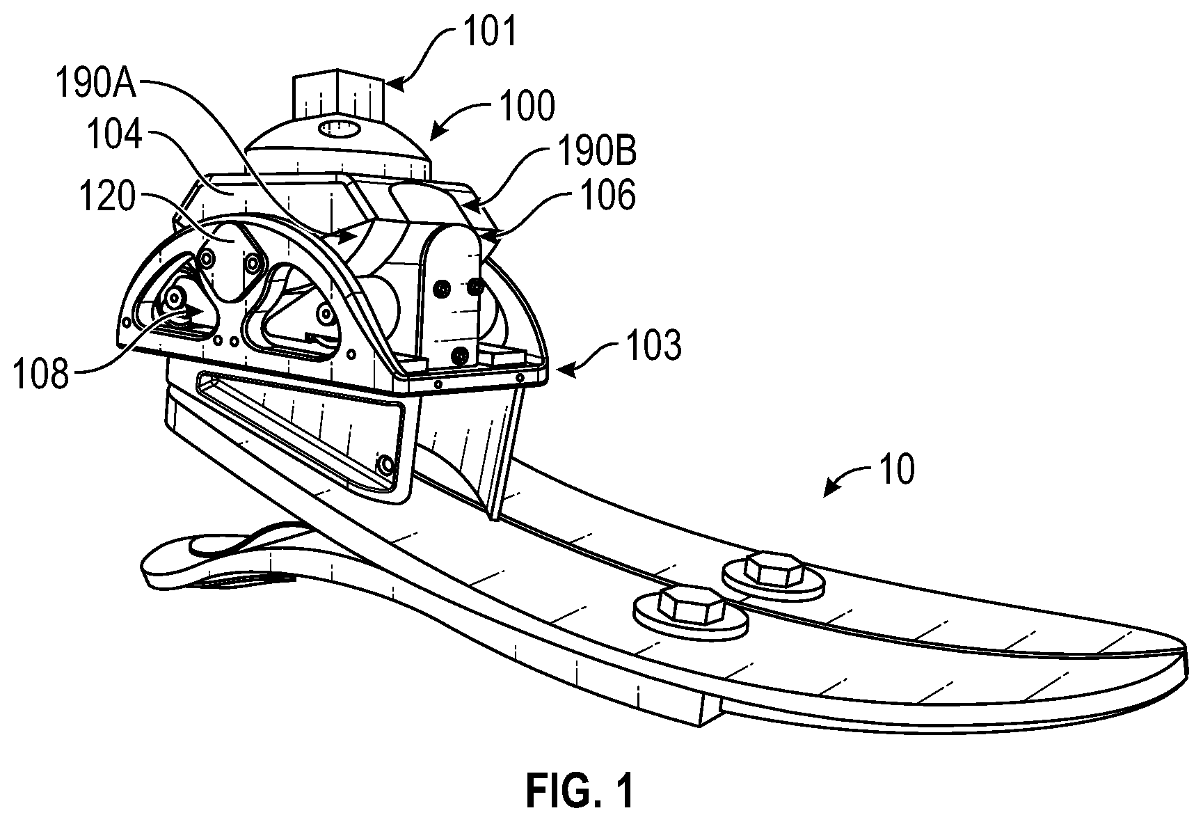 Patent US12616589 — Systems and methods for an ankle prosthesis — Figure 1