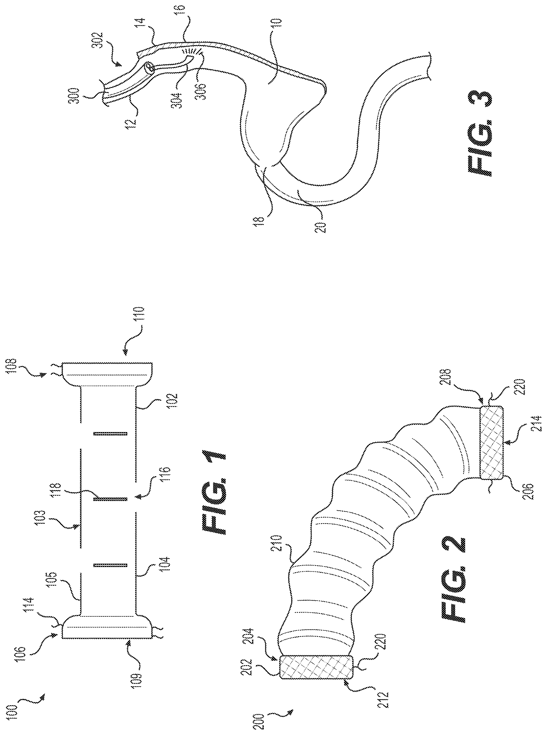 Patent US12616594 — Gastrointestinal bypass devices and related methods of use — Figure 1