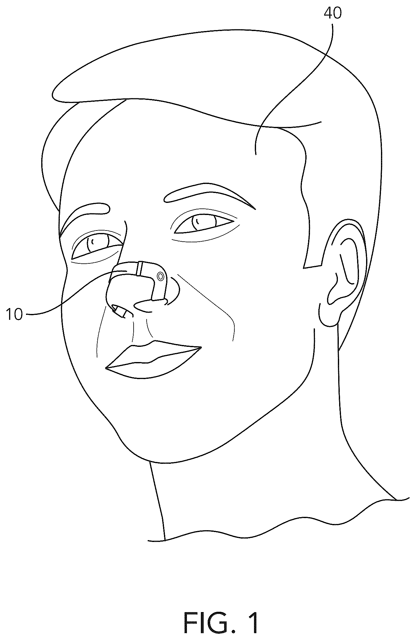 Patent US12616597 Figure 1 – Nasal dilating device