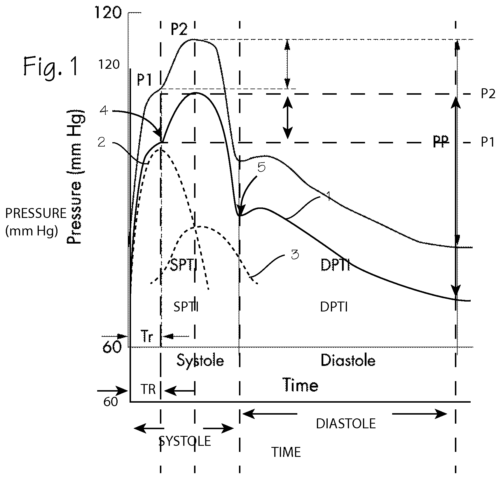 Patent US12616637 Figure 1 – CPR chest compression system with tonometric input and feedback