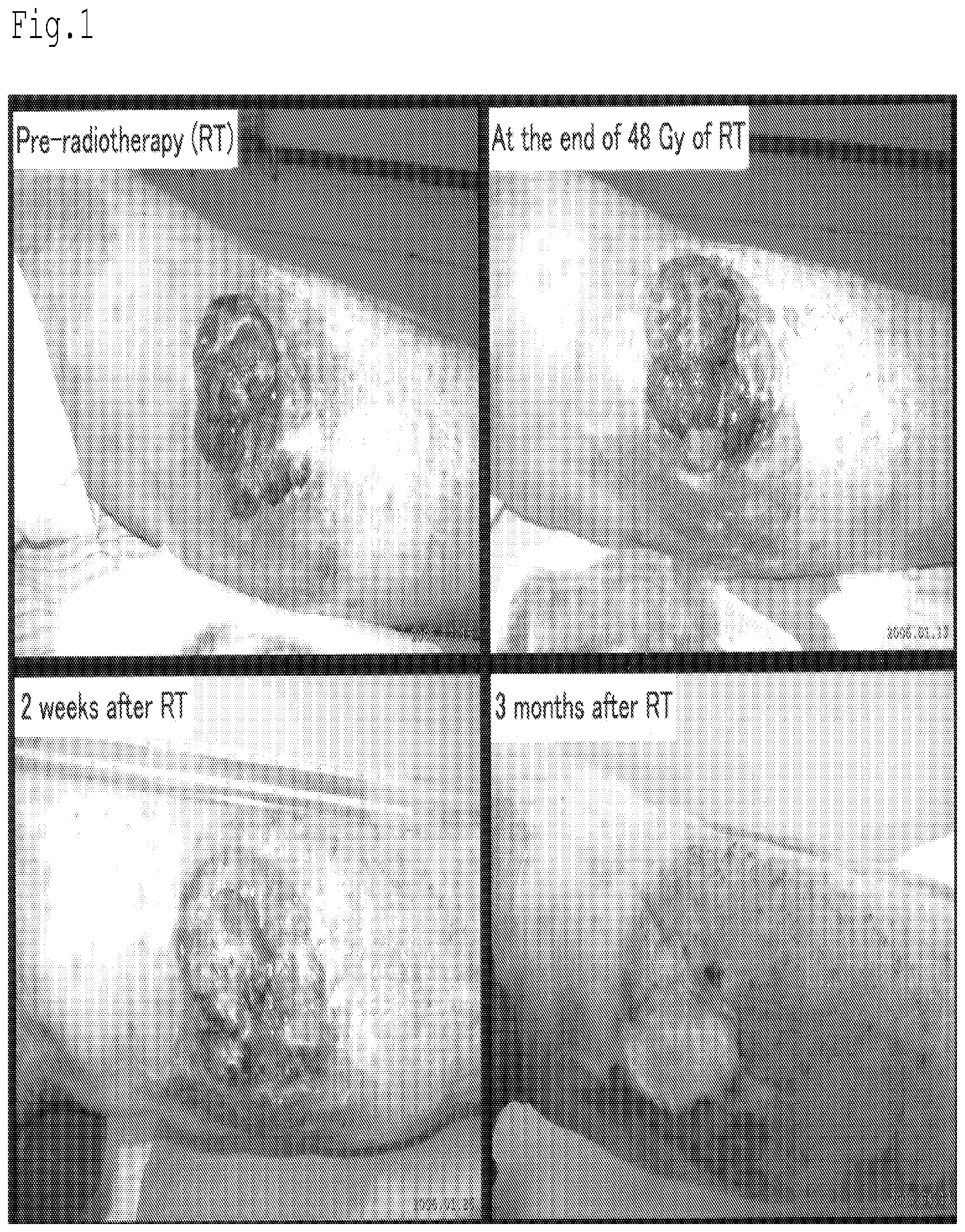 Patent US12616650 — Radiation sensitizer of anti-cancer chemotherapy sensitizer — Figure 1