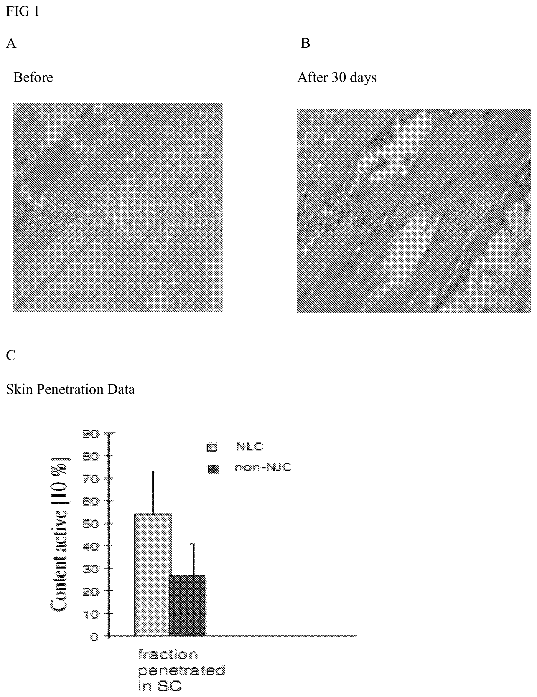 Patent US12616651 — Topical lipolysis composition and methods — Figure 1