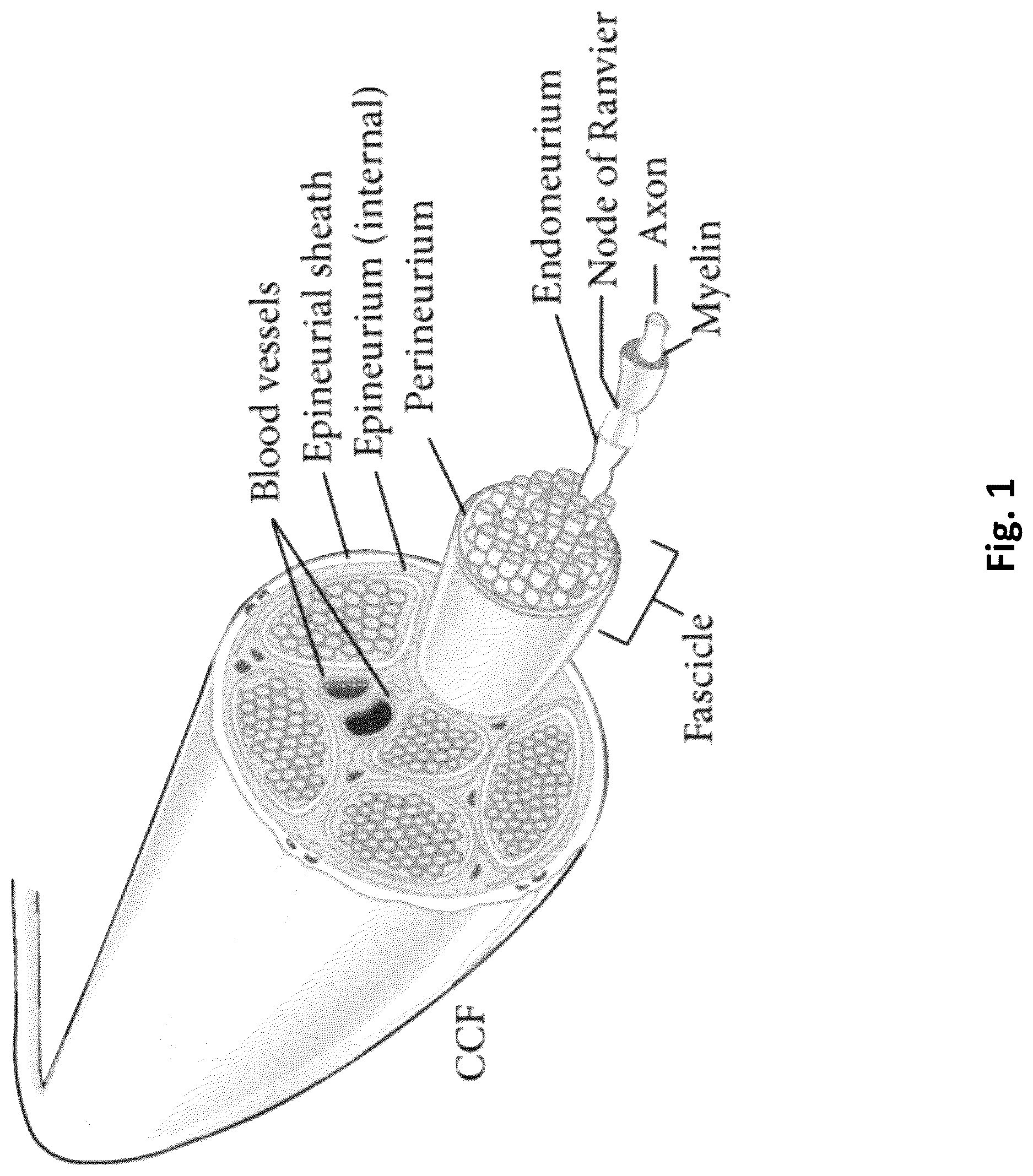 Patent US12616779 — Piezoelectric nerve guidance and regeneration — Figure 1