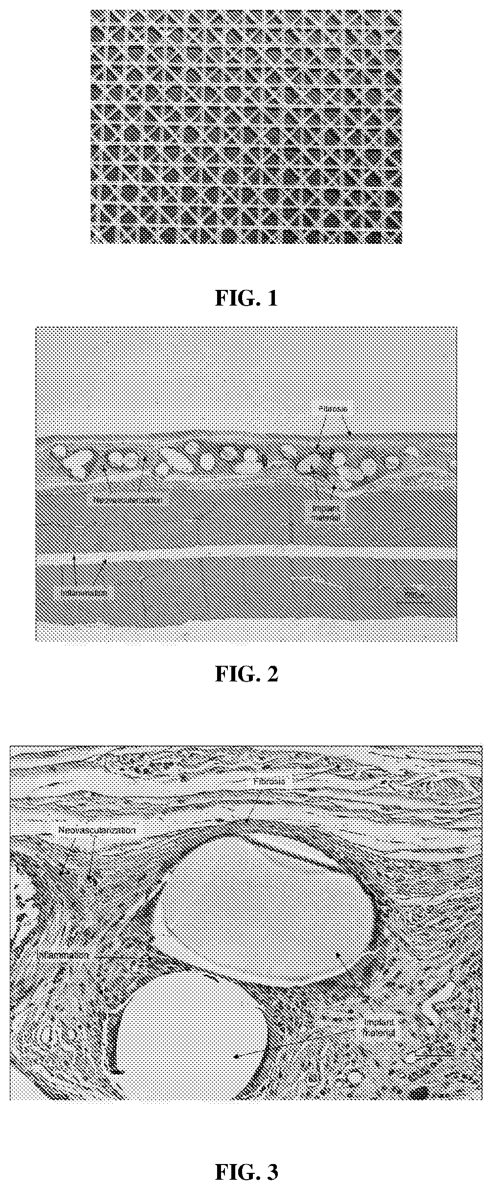 Patent US12616780 — Medical devices containing compositions of poly(butylene succinate) and copolymers thereof — Figure 1