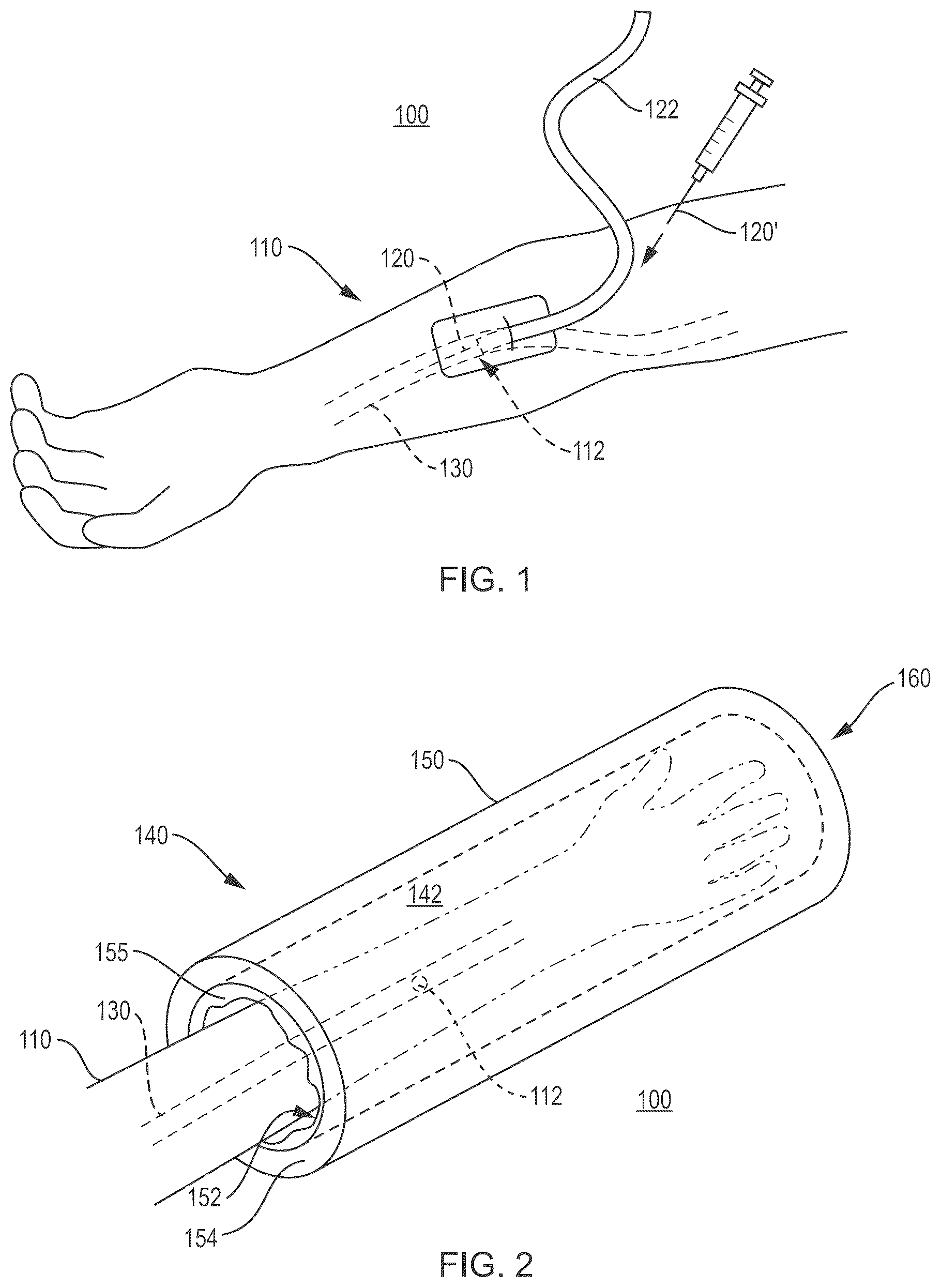 Patent US12616801 — Phlebotomy aid device — Figure 1
