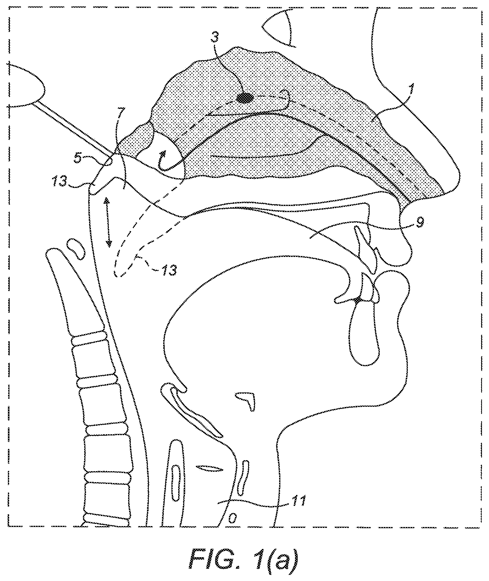 Patent US12616806 — Nasal administration — Figure 1