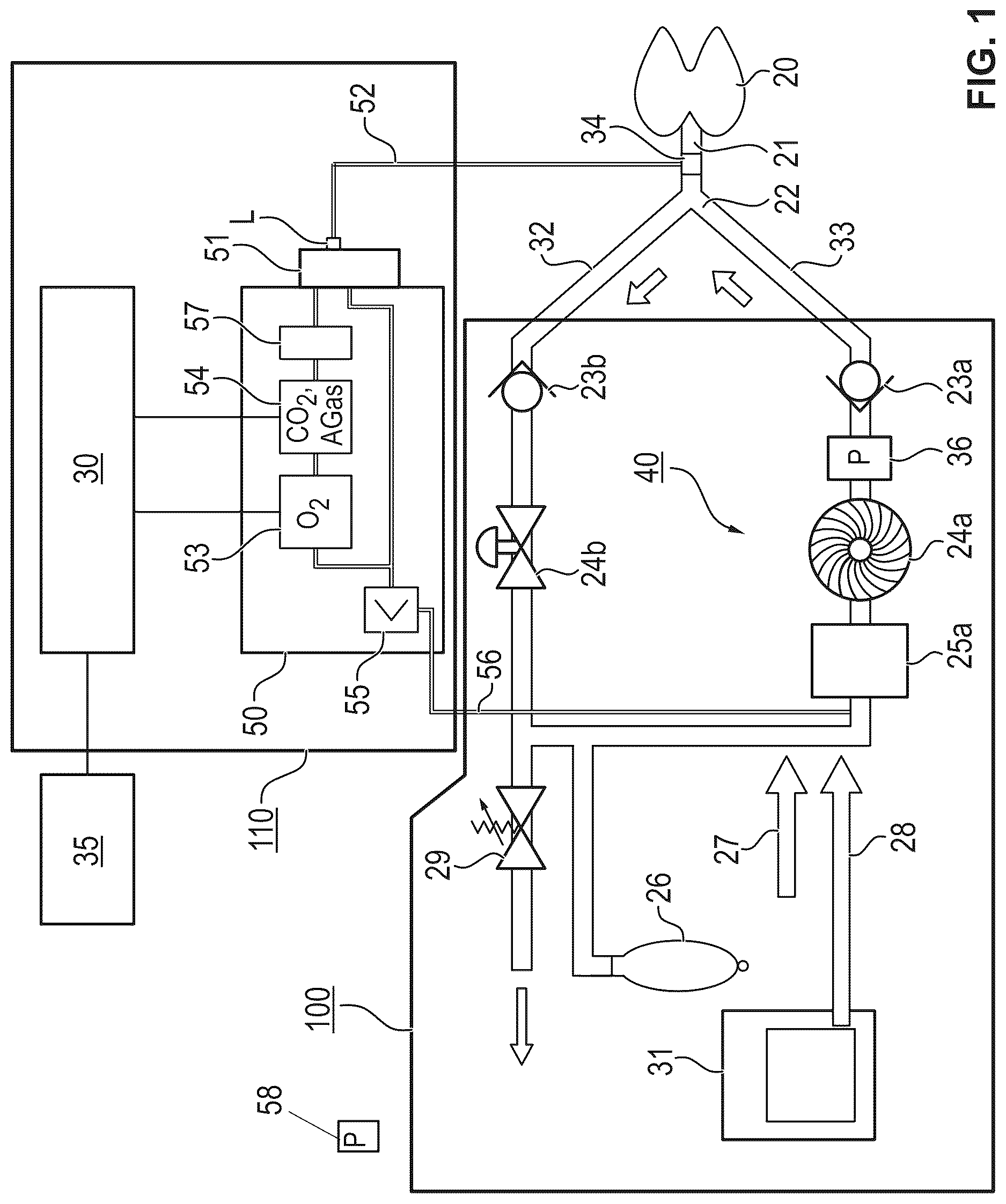 Patent US12616808 Figure 1 – Process and device for detection of a leak in a ventilation circuit