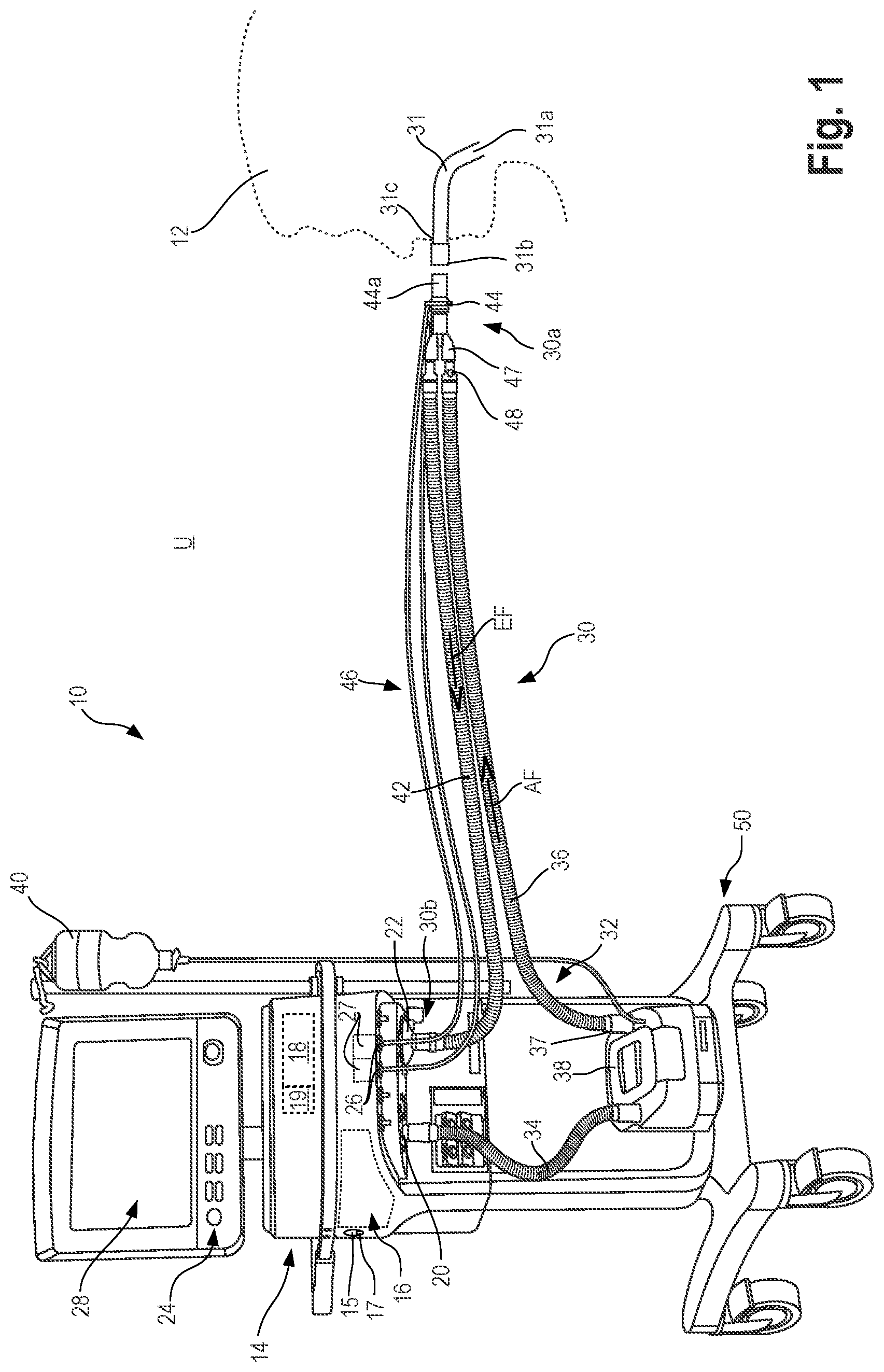 Patent US12616809 Figure 1 – Method for carrying out a P/V maneuver which automatically prevents an overdilation of the lungs, and ventilation device designed to carry out the method