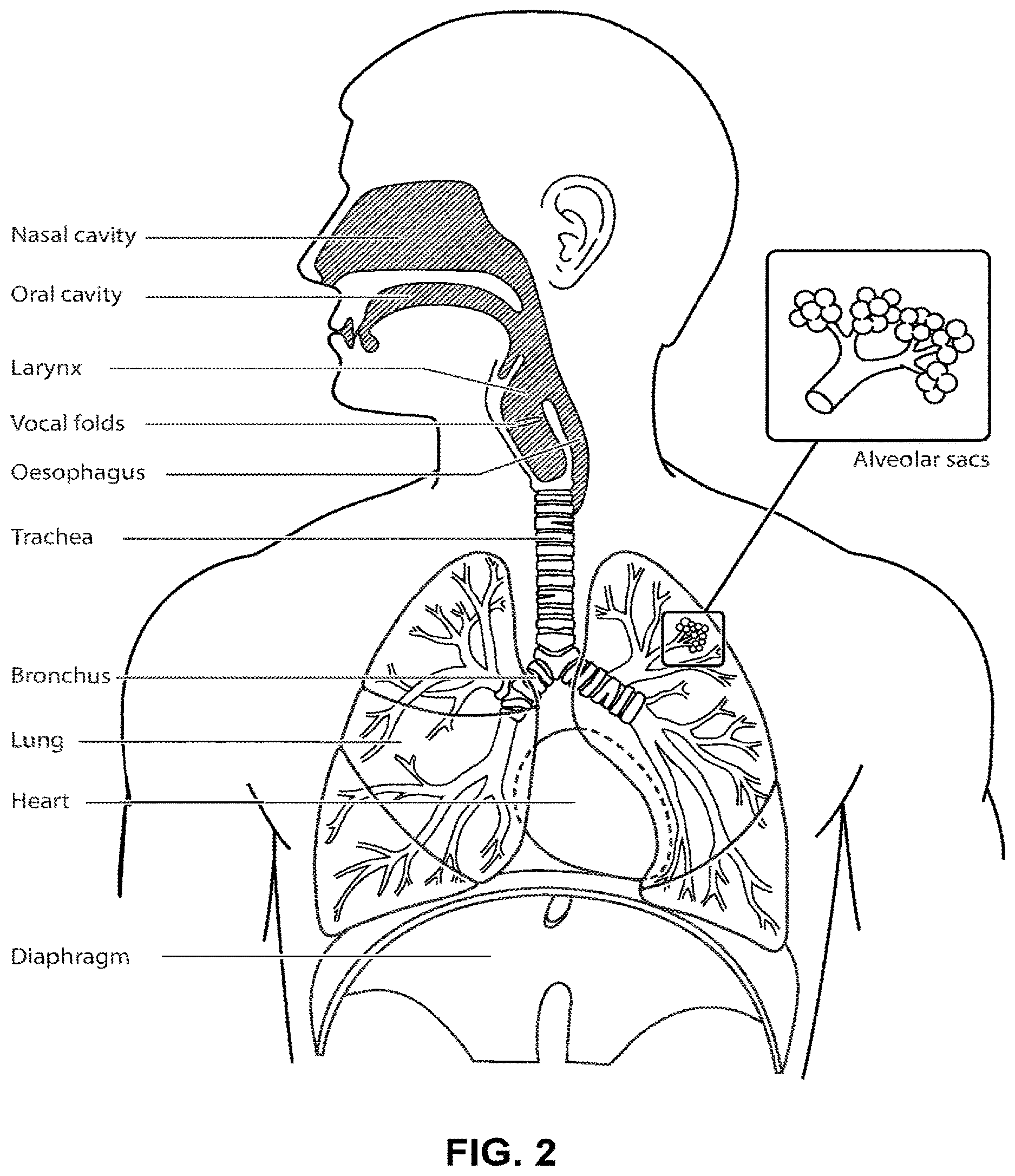 Patent US12616812 Figure 2 – Methods and apparatus for treating respiratory disorders