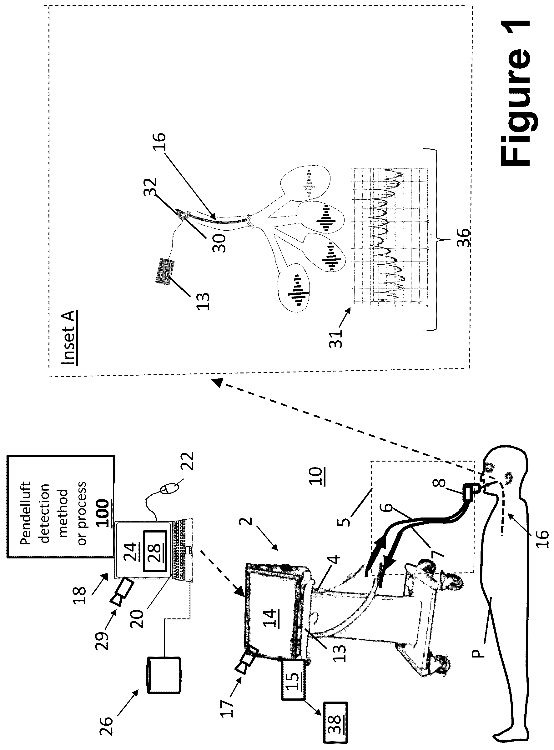 Patent US12616813 — Pendelluft detection by acoustic interferometry through an endotracheal tube — Figure 1