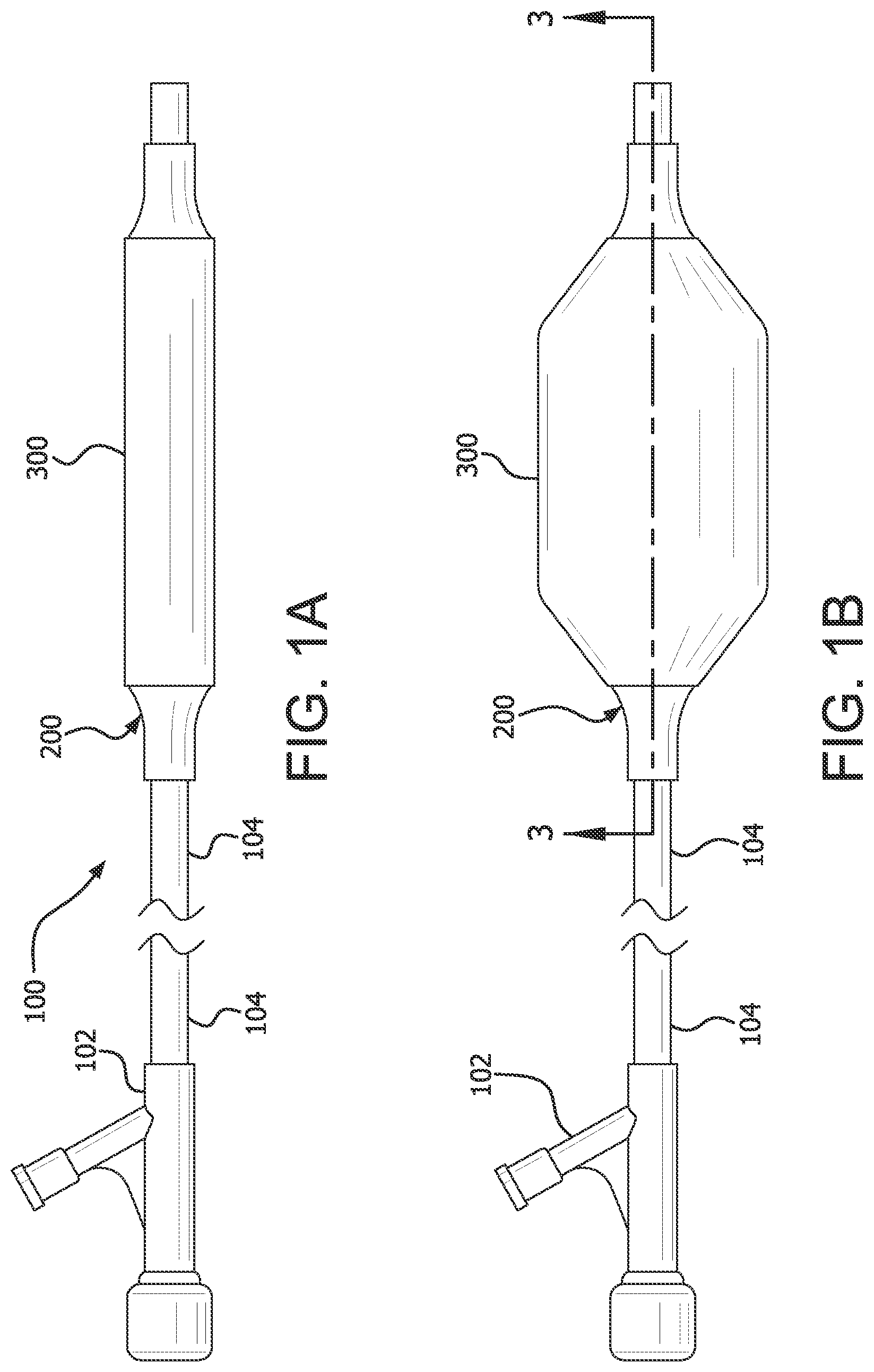Patent US12616819 — Controllable inflation profile balloon cover methods — Figure 1