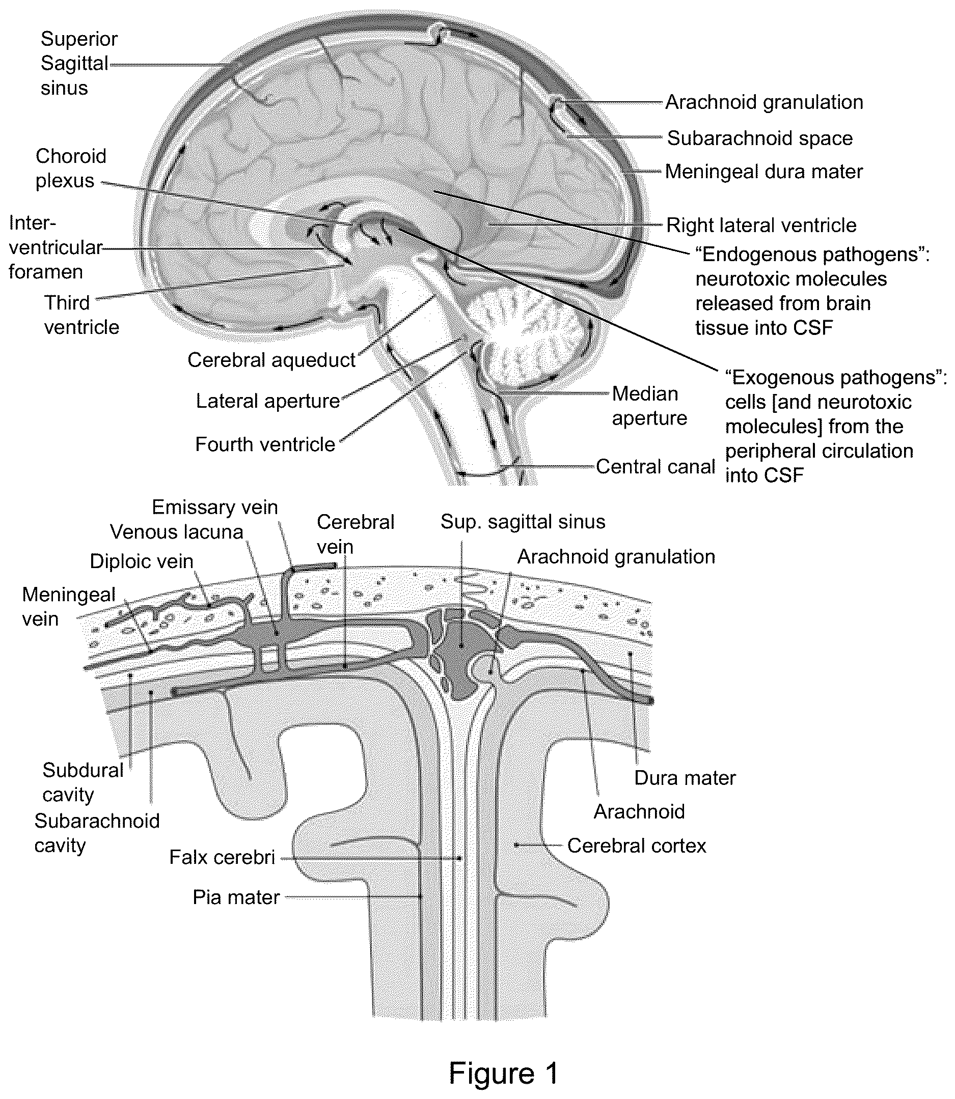 Patent US12616822 — Cerebrospinal fluid purification system — Figure 1