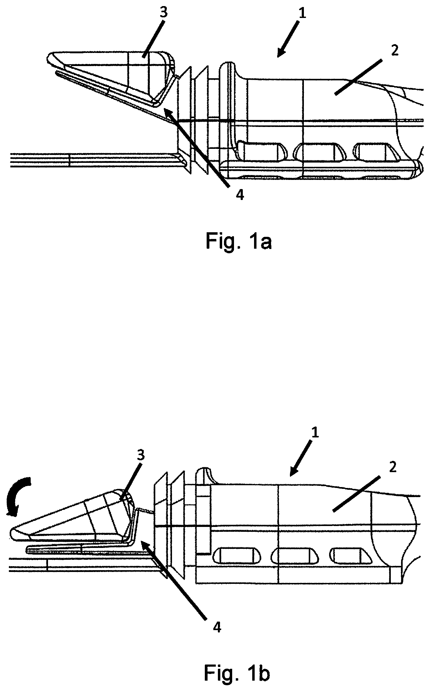 Patent US12616825 — Implantable access device for accessing the vascular system of a human or animal body, particularly subcutaneously implantable access port — Figure 1
