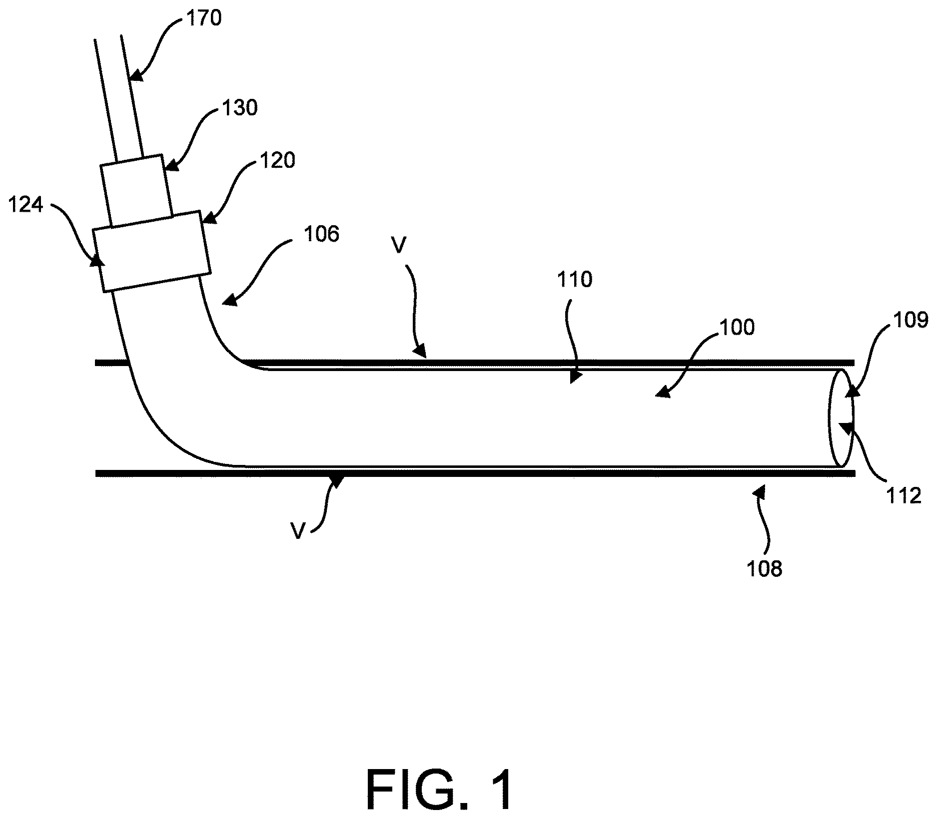 Patent US12616826 — Push-pull tightening port for percutaneous circulatory support device repositioning and axial locking, and attachment to sheath hub — Figure 1