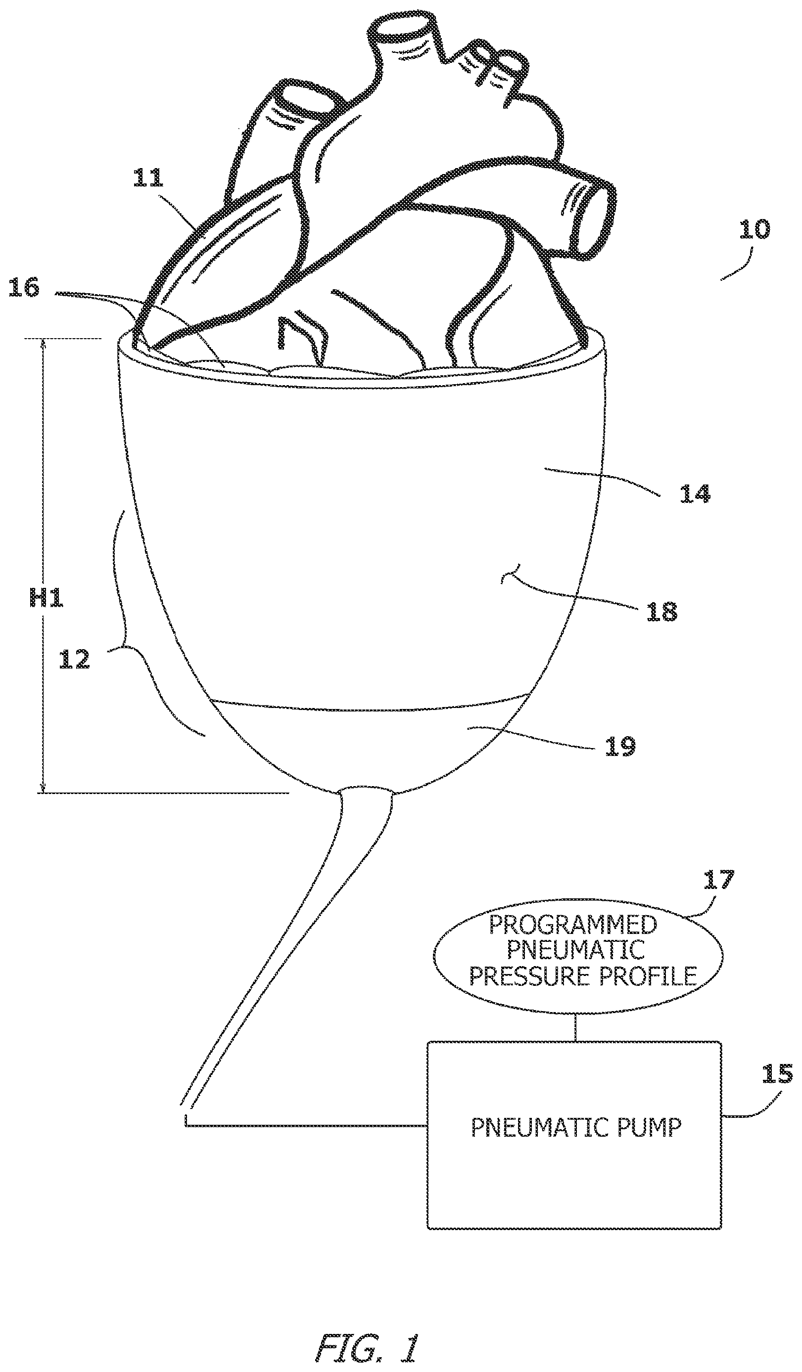Patent US12616827 — System and method for assisting the heart in pumping blood — Figure 1