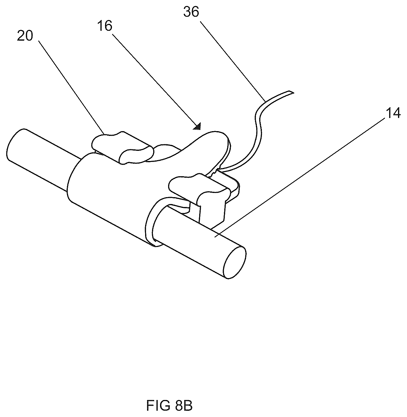 Patent US12616832 Figure 16 – Systems and methods for delivering neuroregenerative therapy