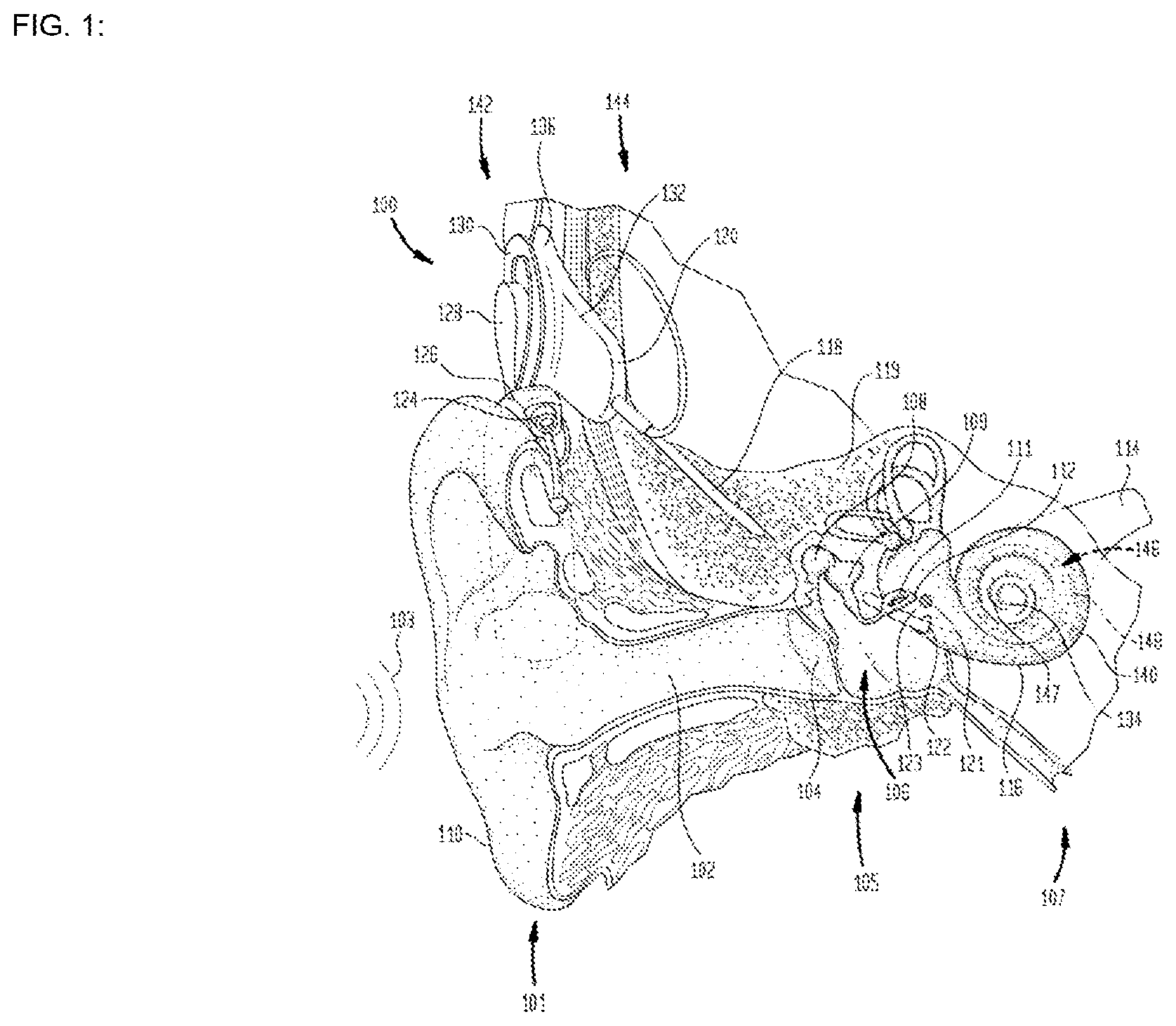 Patent US12616842 — Self-locking fixation system for medical implant — Figure 1