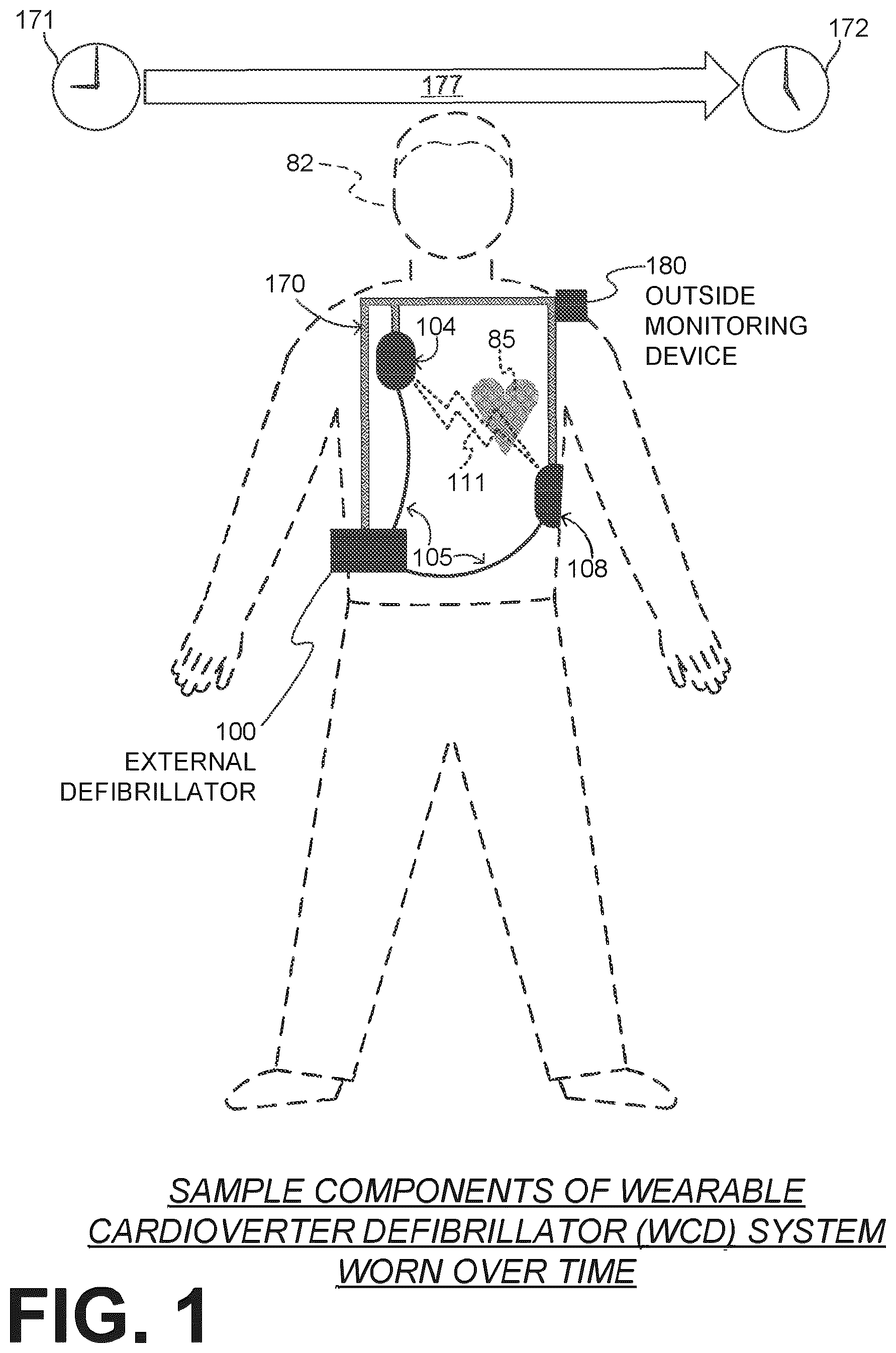 Patent US12616844 — Substantially-median-based determination of long-term heart rates from ECG data of wearable cardioverter defibrillator (WCD) system — Figure 1