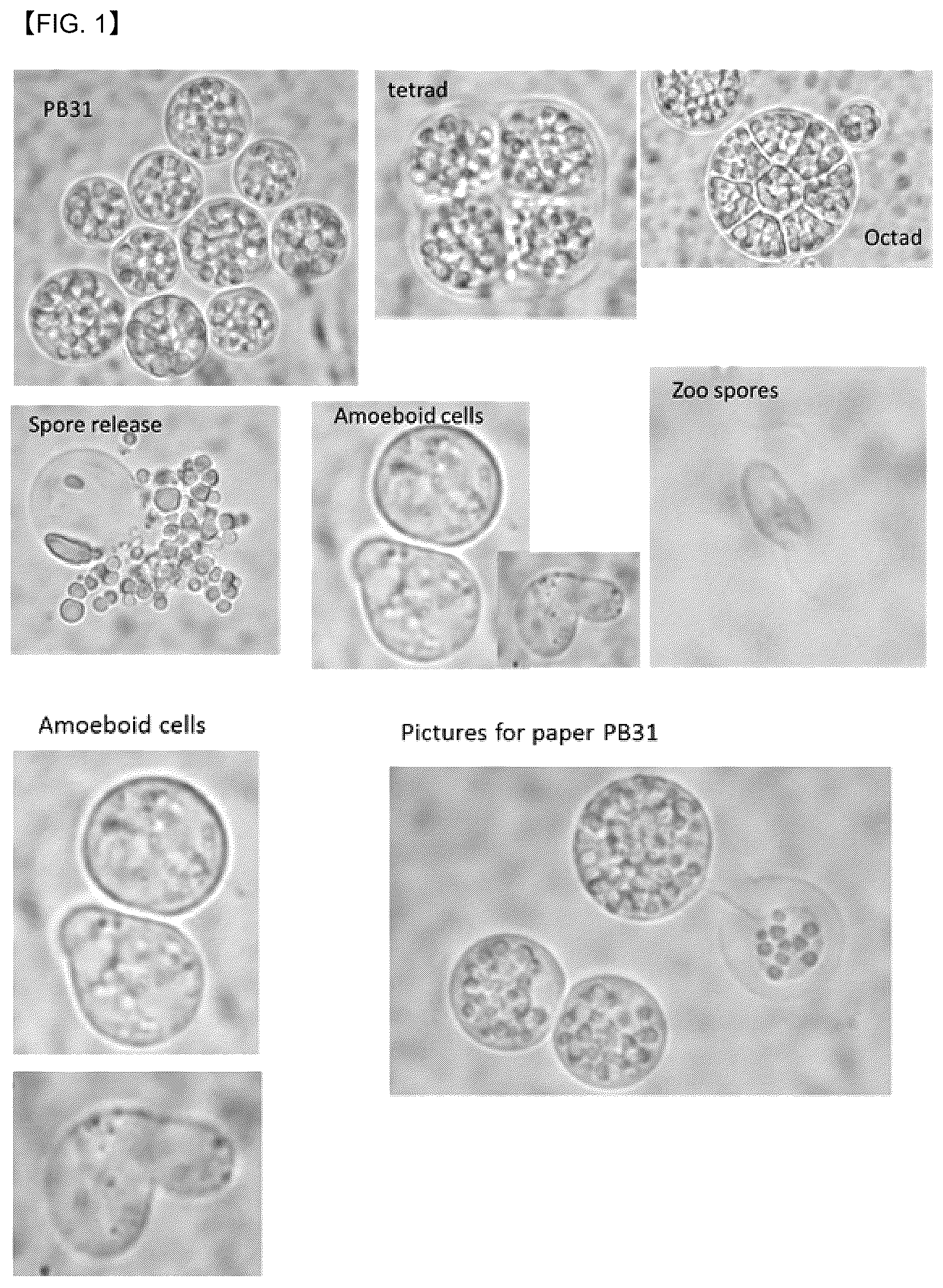Patent US12618087 Figure 1 – Thraustochytrid strain genetically engineered for the production of biomaterials including long-chain polyunsaturated fatty acids
