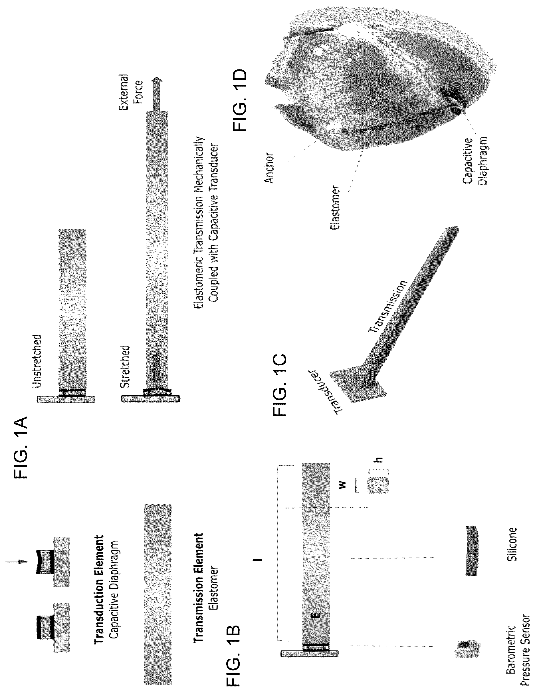 Patent US12618660 — Implantable, stretchable sensor for continuous biomechanical monitoring of the heart — Figure 1