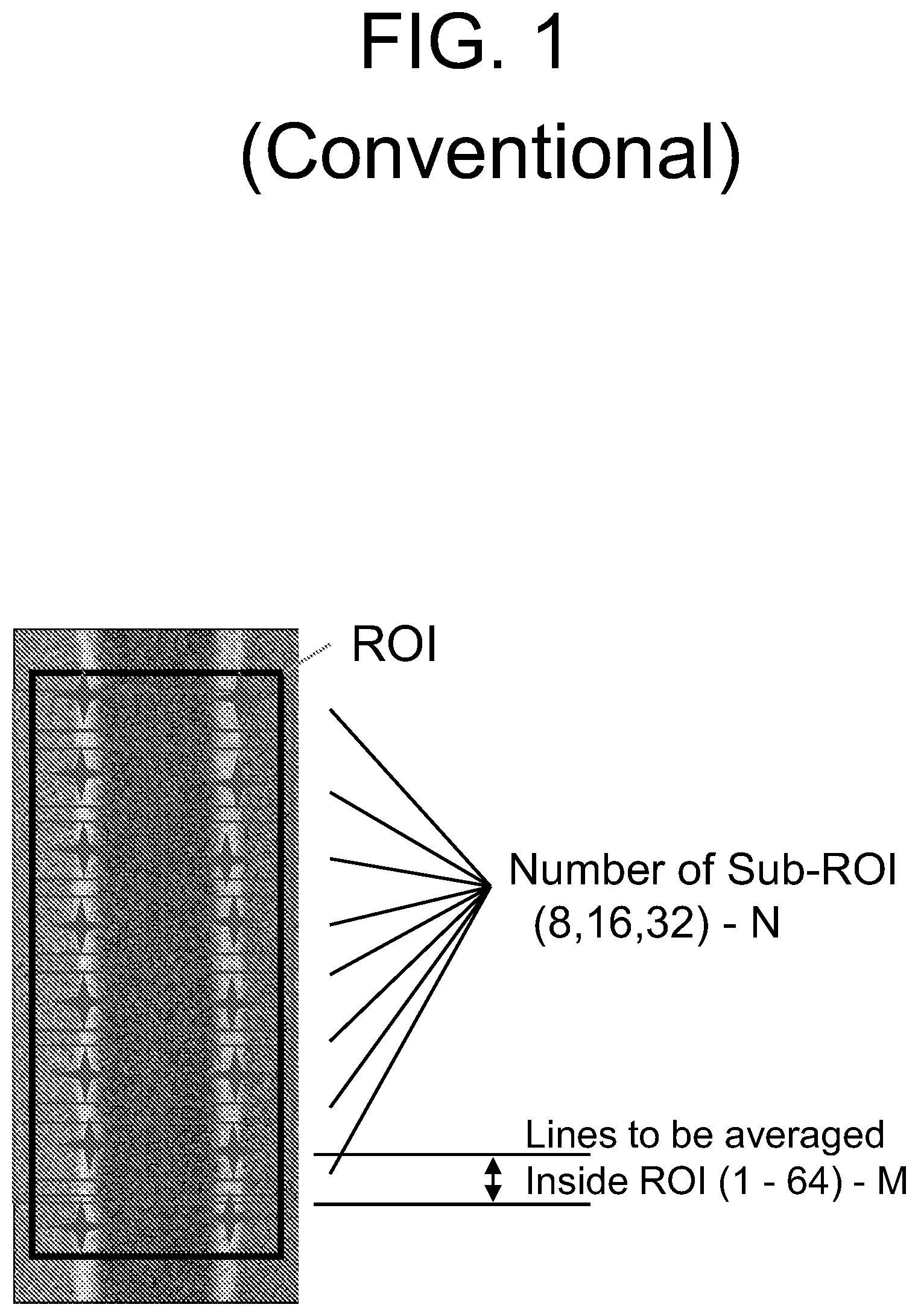 Patent US12618788 — System and method for denoising a region of interest of a pattern — Figure 1
