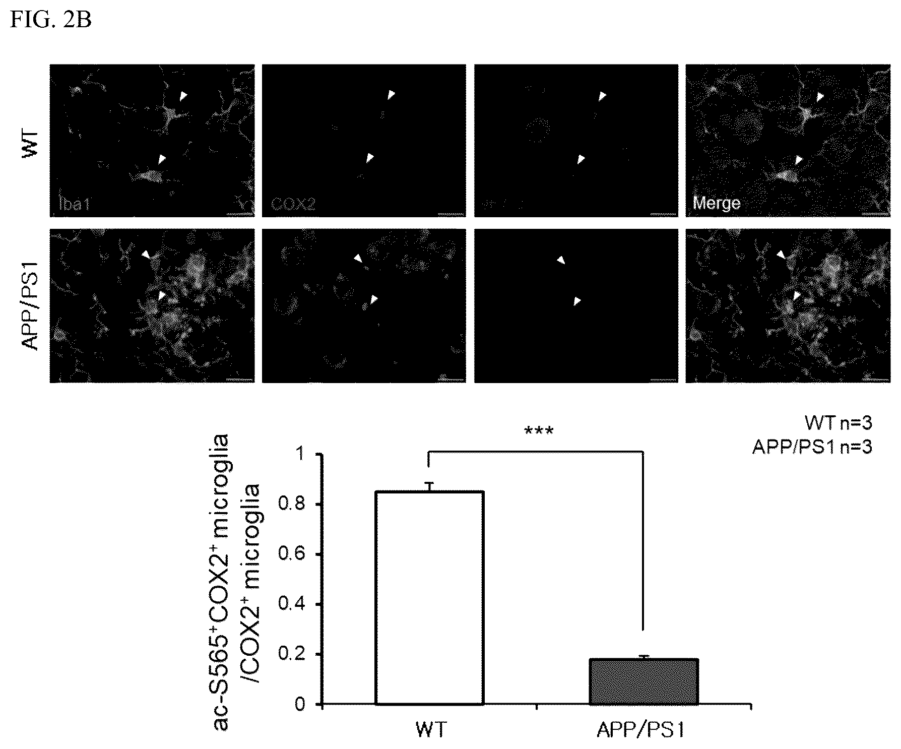 Patent US12618840 Figure 4 – Antibody for detecting acetylation of COX2 protein, and uses thereof
