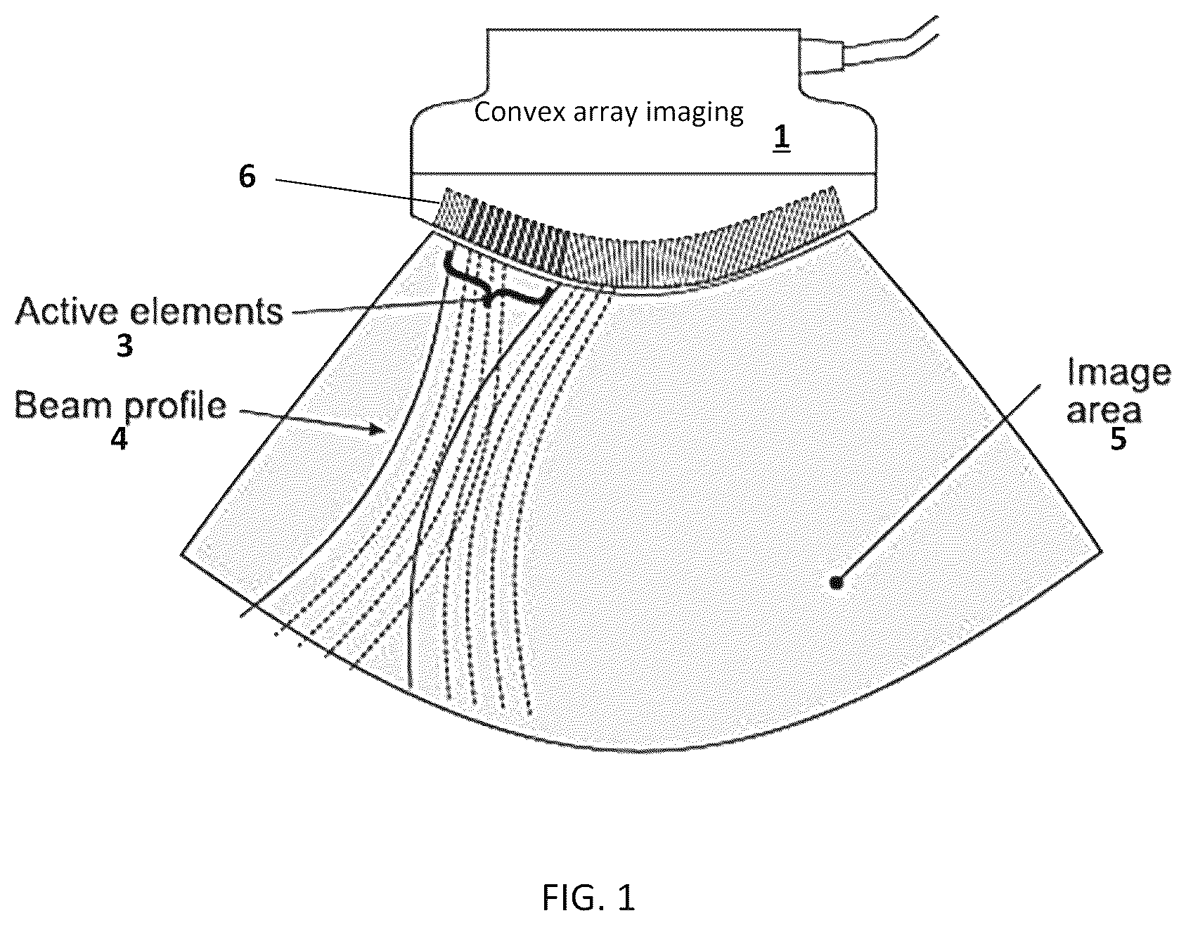 Patent US12618955 — Adaptive retrospective transmit beamforming (RTB) for a lowpower handheld ultrasound scanner — Figure 1
