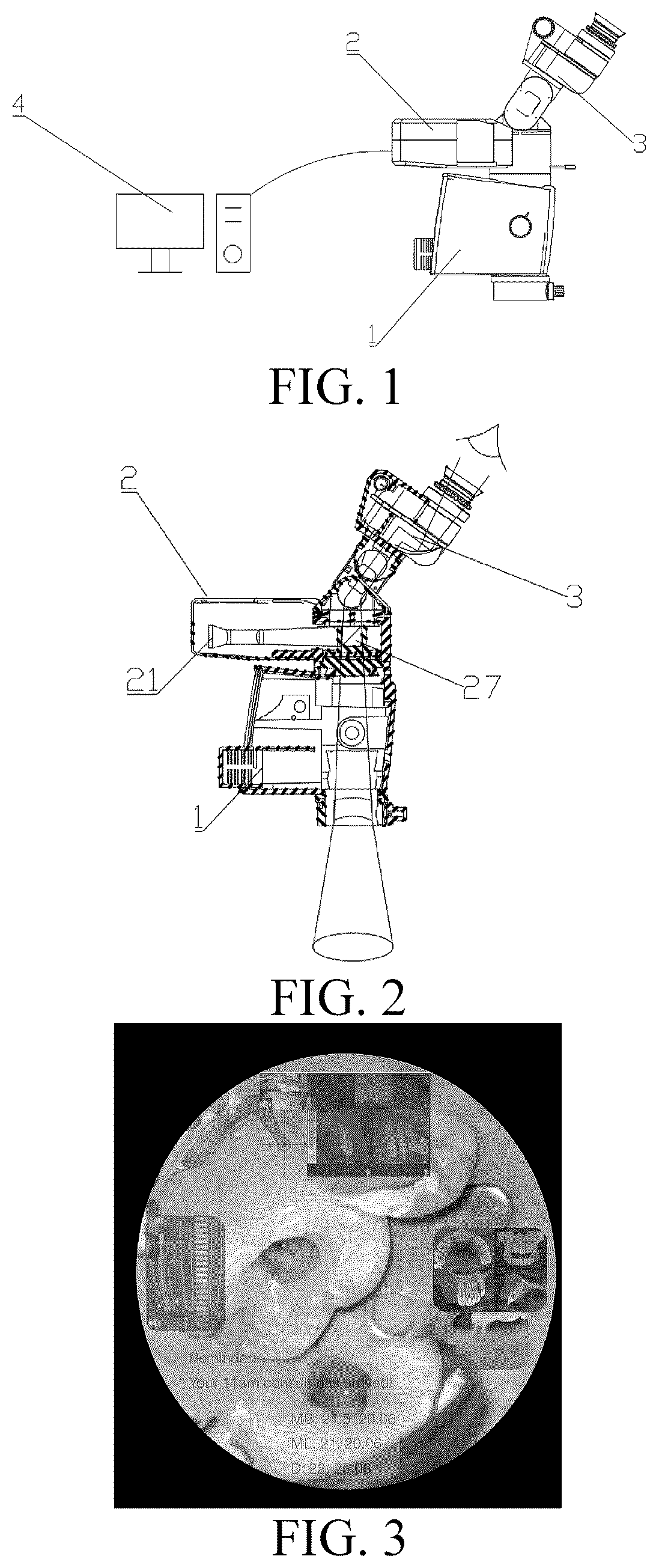 Patent US12619059 — Image enhancement system and implementation method therefor — Figure 1