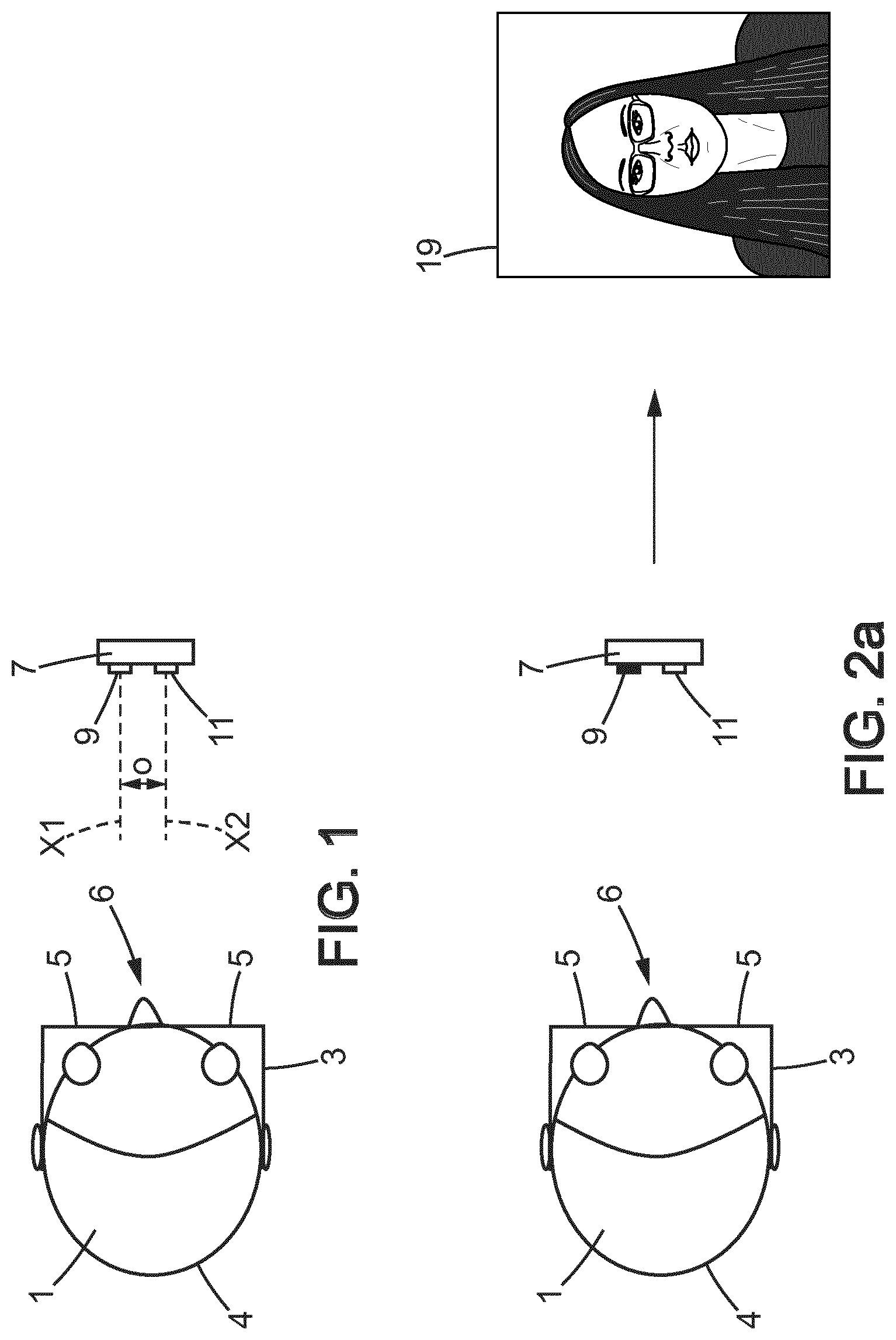 Patent US12619107 — Photography and thermography combining method of obtaining a fitting parameter to fit an ophthalmic lens into a spectacle frame — Figure 1