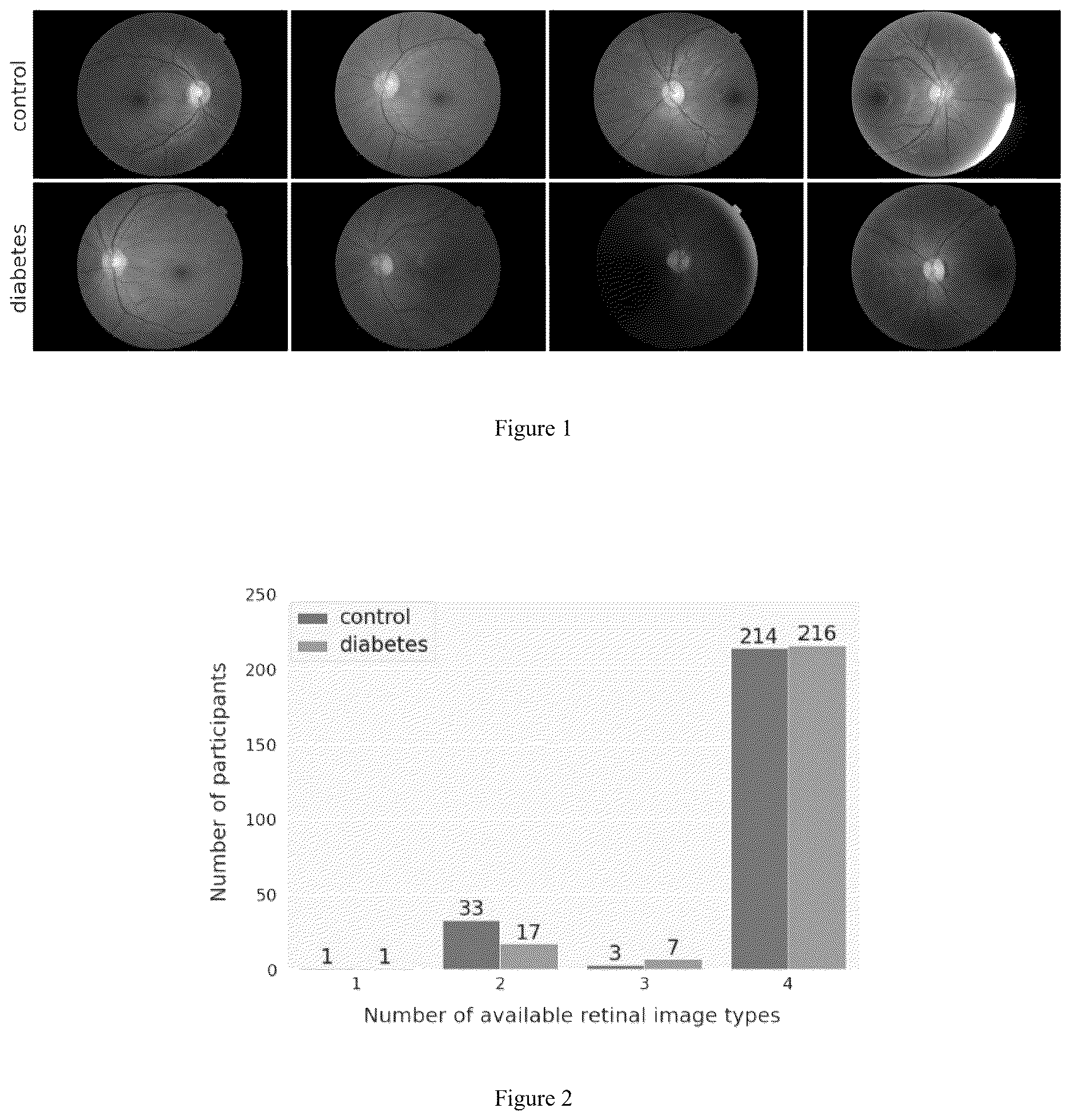 Patent US12620087 — Dianet: a deep learning based architecture to diagnose diabetes using retinal images only — Figure 1