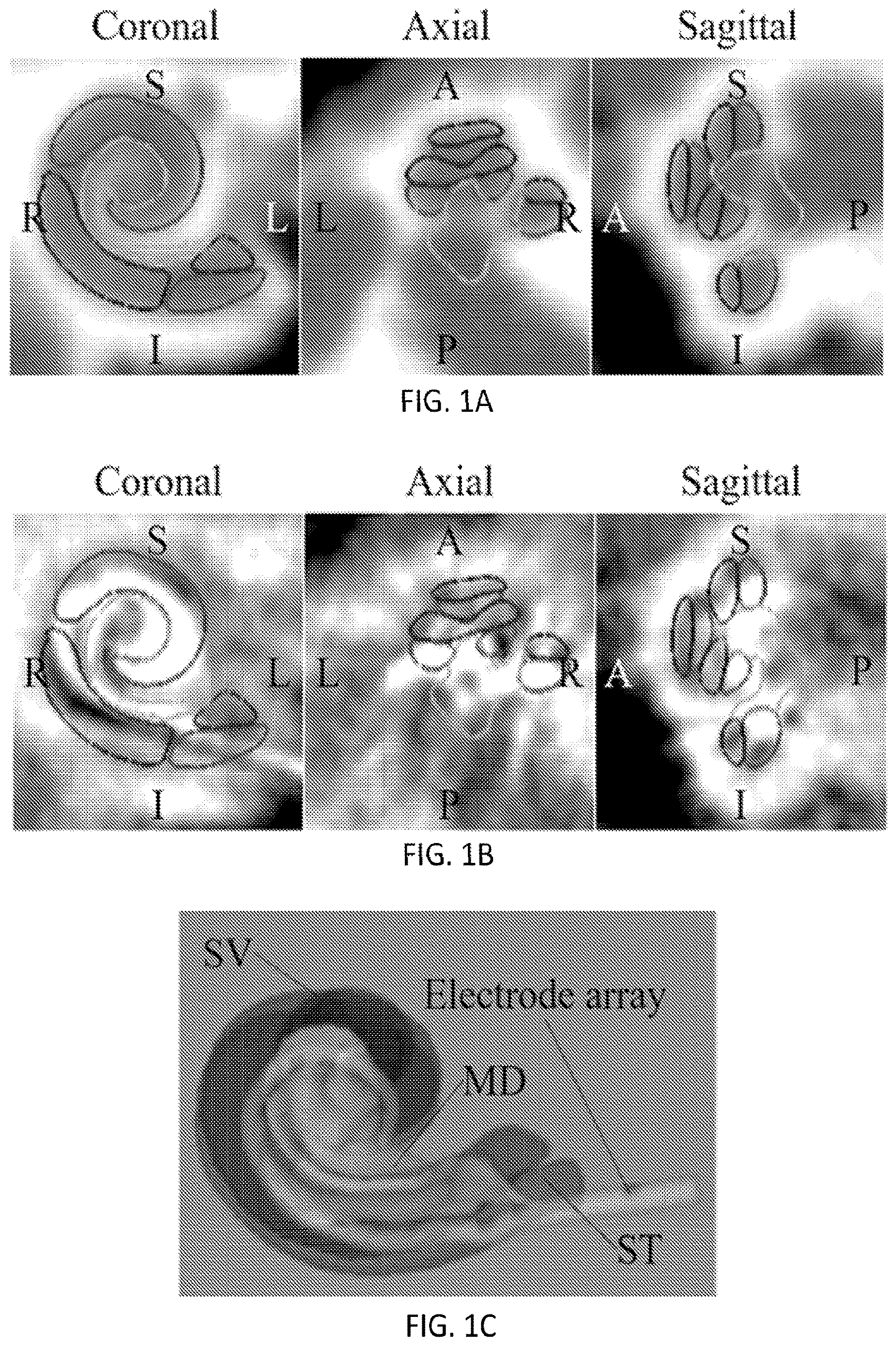 Patent US12620091 Figure 1 – Methods of automatic segmentation of anatomy in artifact affected CT images with deep neural networks and applications of same