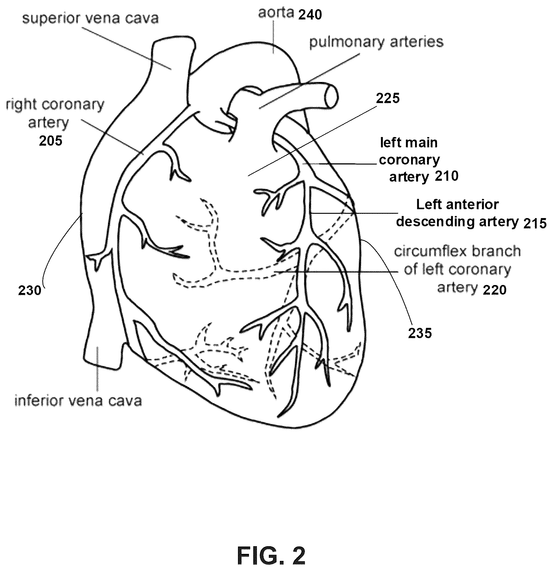 Patent US12620092 Figure 2 – Systems, devices, and methods for non-invasive image-based plaque analysis and risk determination