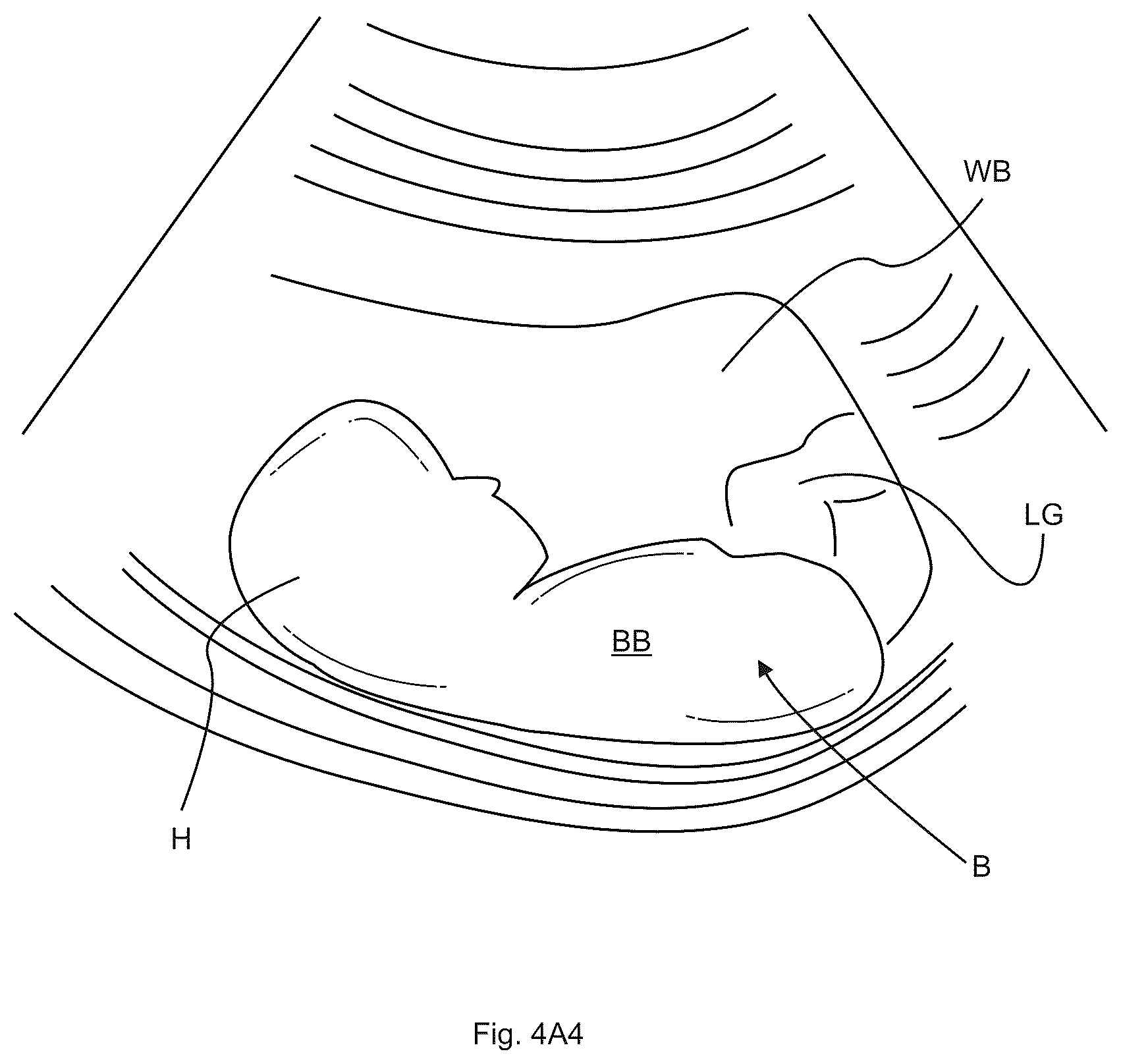Patent US12620112 Figure 7 – Subsurface imaging and display of 3D digital image and 3D image sequence