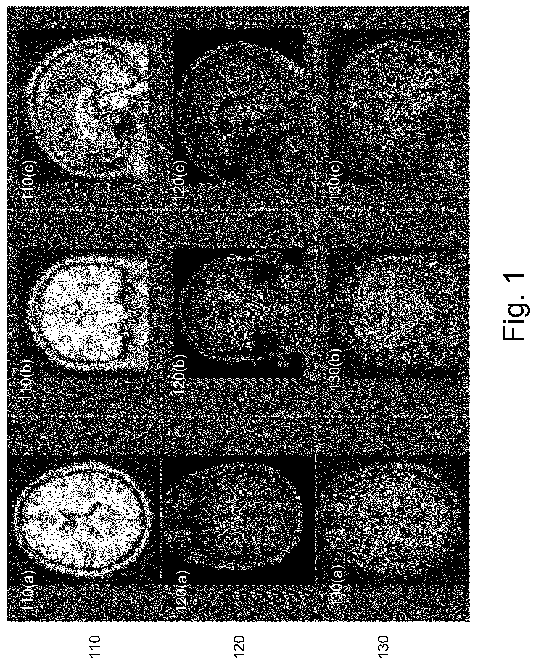 Patent US12620169 Figure 1 – Dense non-rigid volumetric mapping of image coordinates using sparse surface-based correspondences