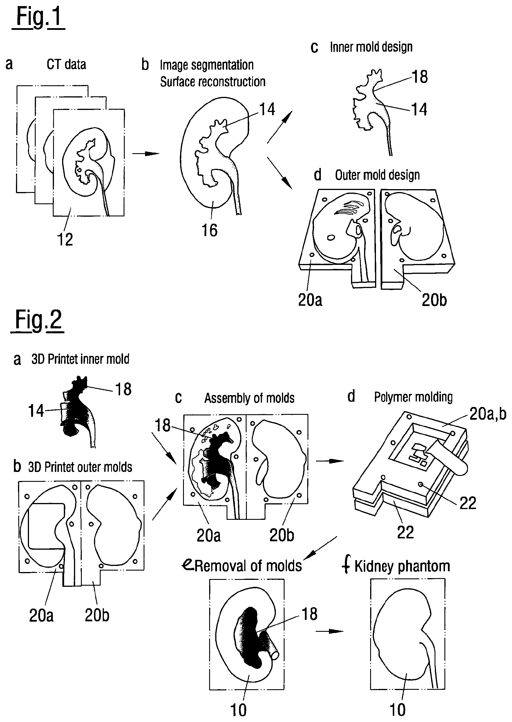 Patent US12620324 — Method of assessing the performance of a human or robot carrying out a medical procedure and assessment tool — Figure 1