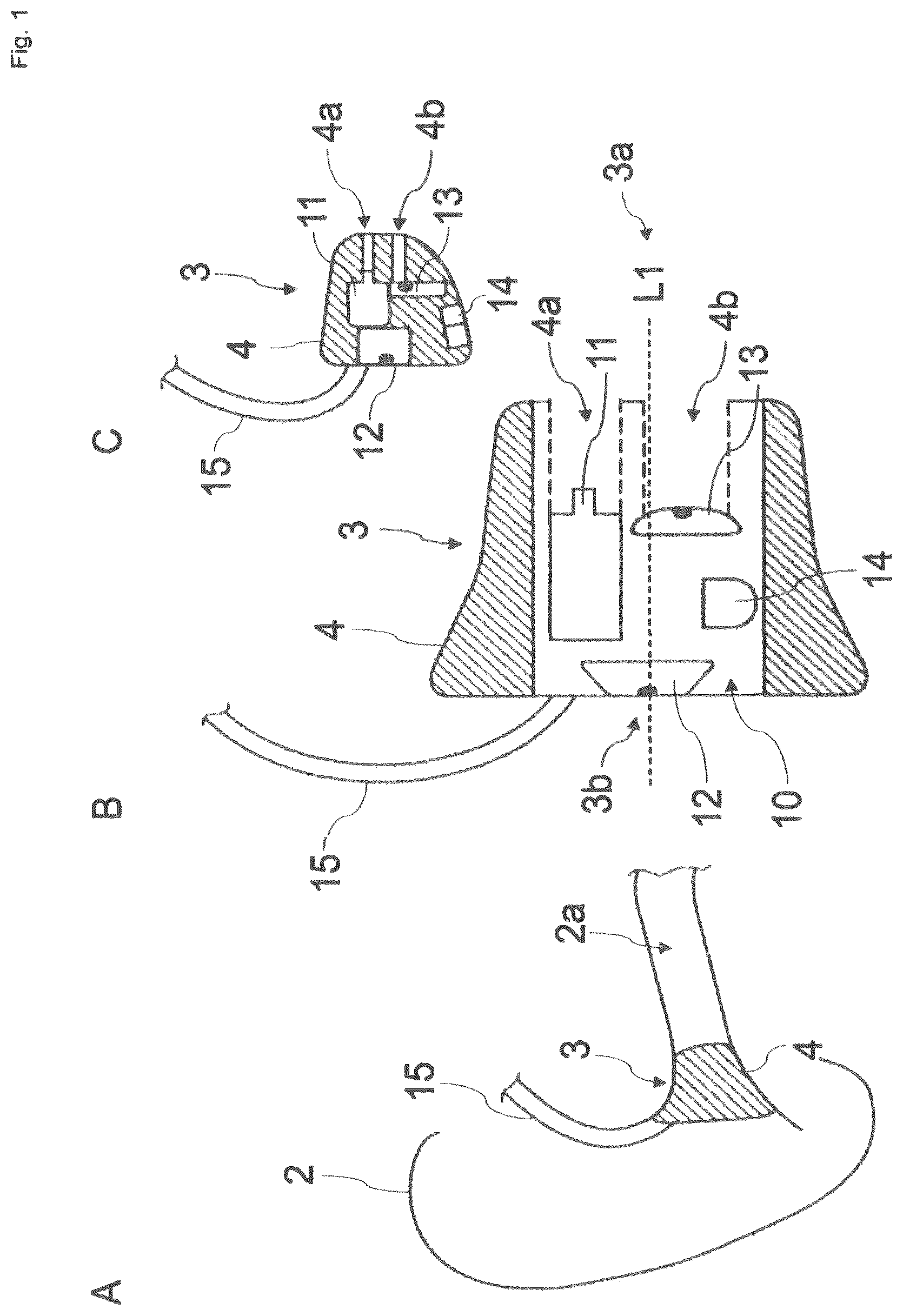 Patent US12621596 — Ear worn device — Figure 1