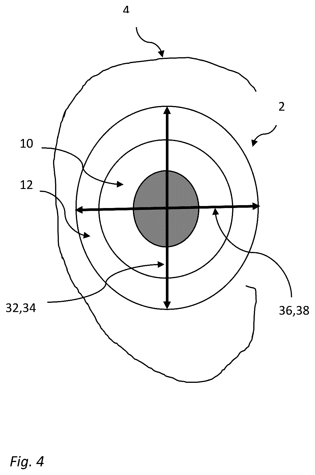 Patent US12621599 Figure 4 – On-the-ear ear cushion with multiple foams having different properties