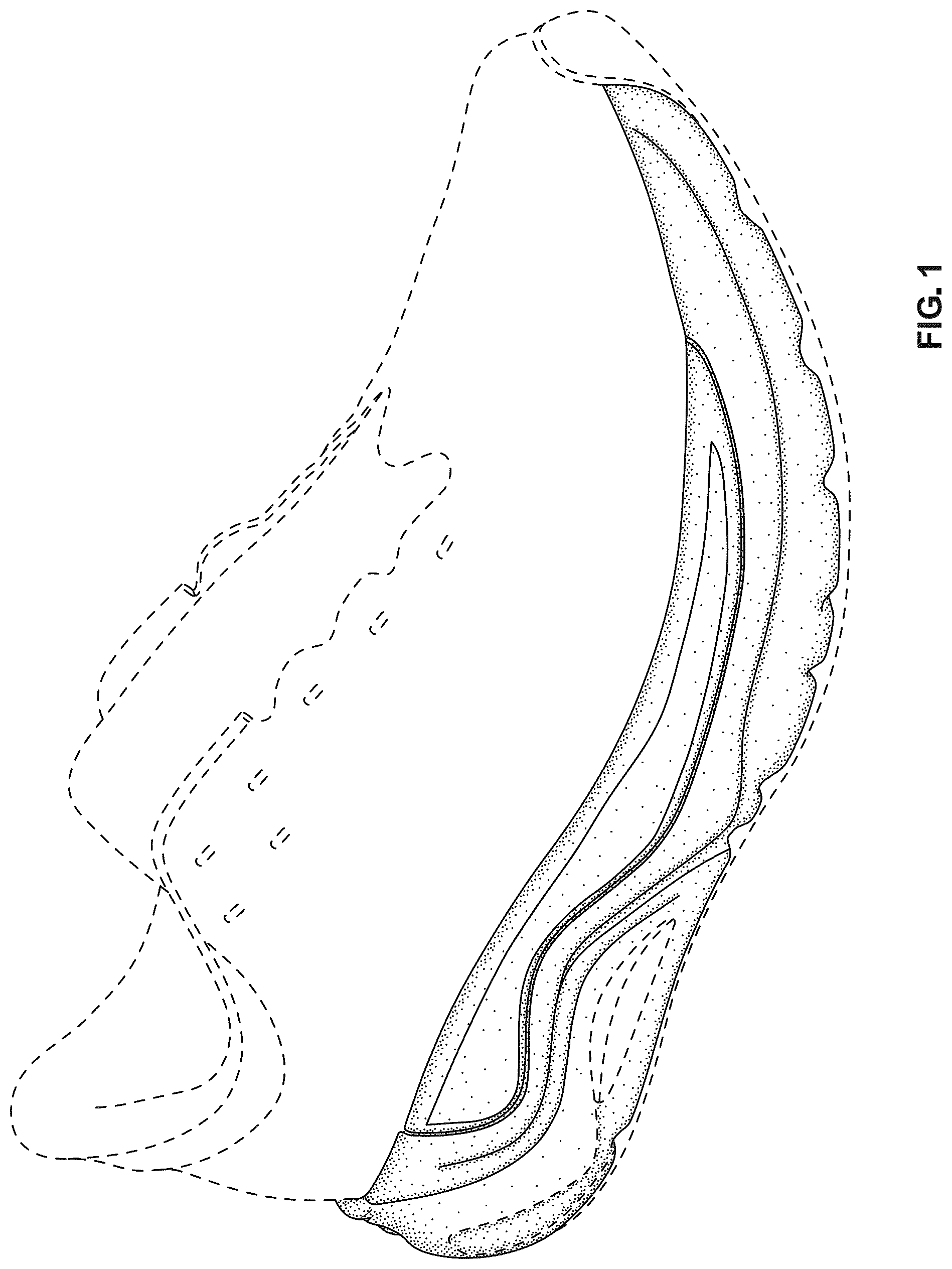 Patent USD1123340 — Footwear midsole — Figure 1