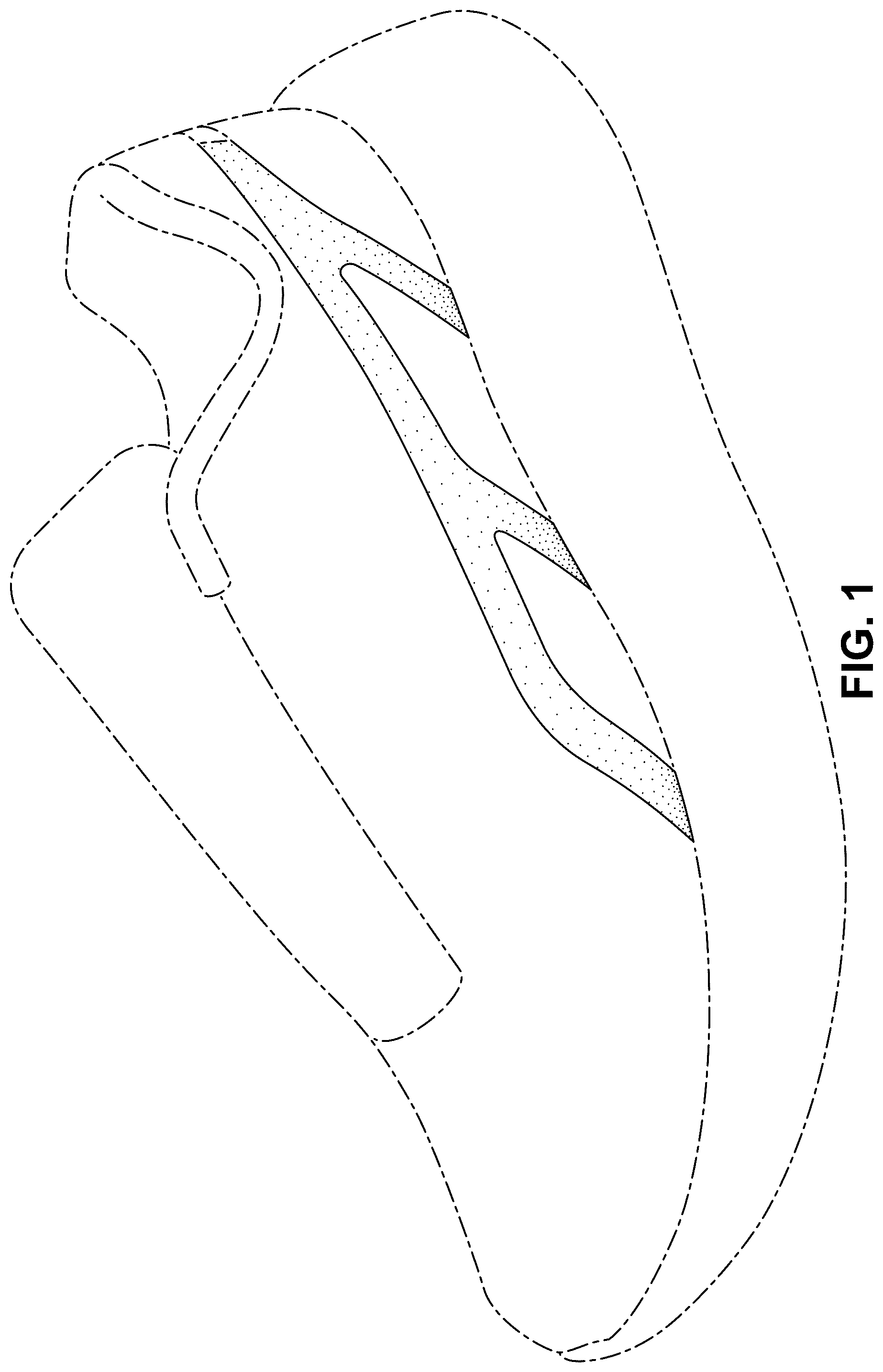 Patent USD1124623 Figure 1 – Shoe