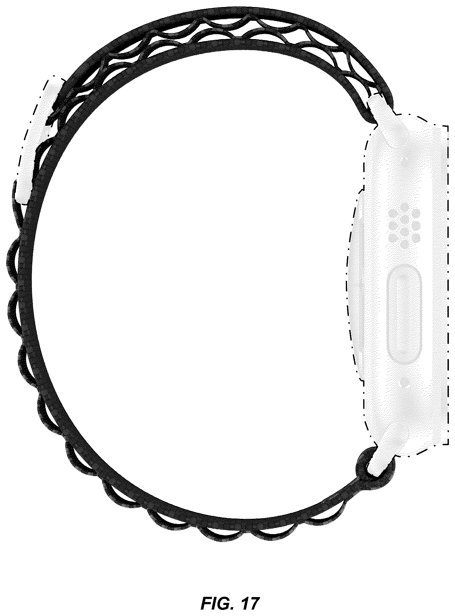 Patent USD1125156 Figure 17 – Wearable device